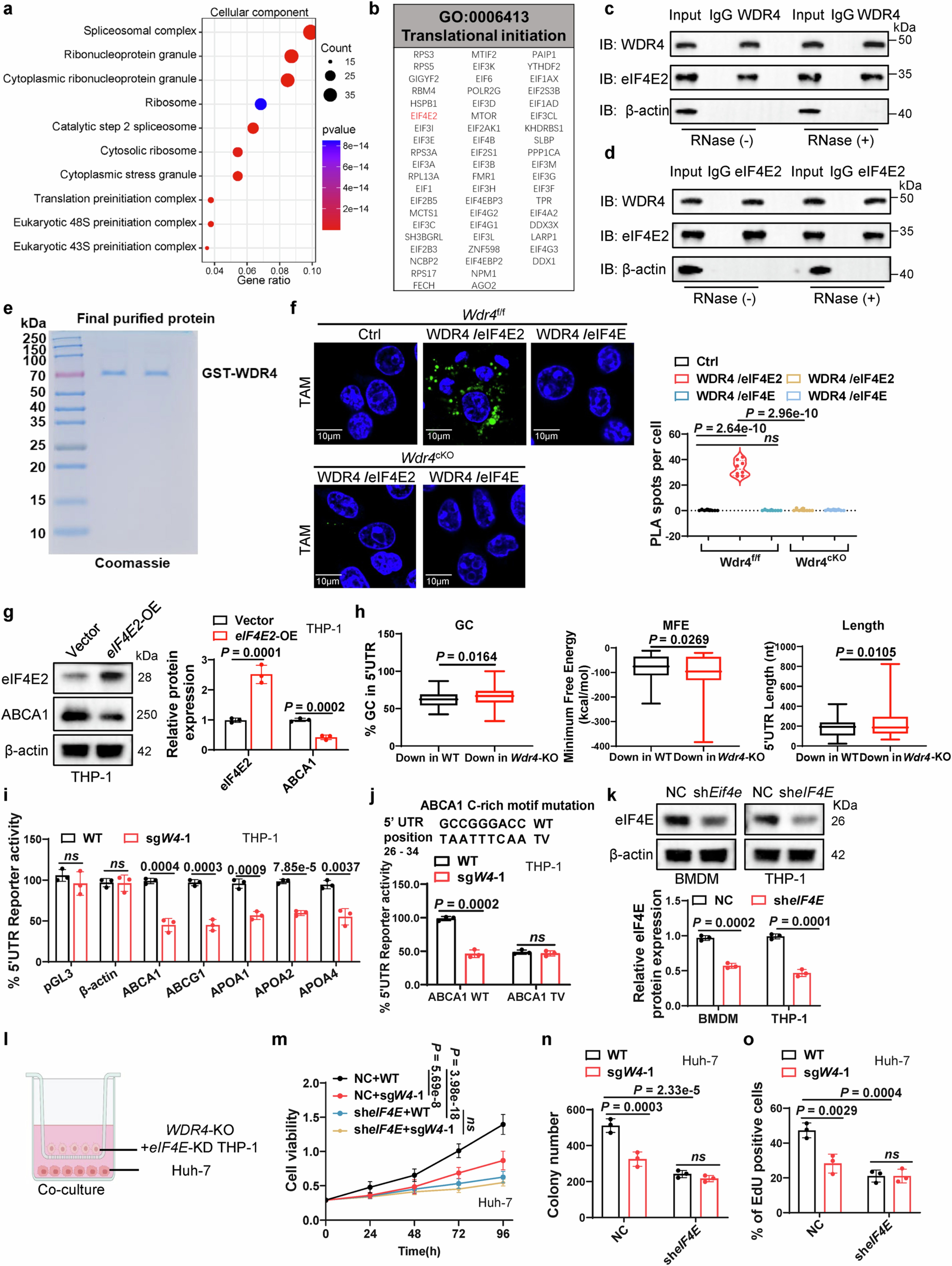 Extended Data Fig. 9: WDR4 interacts with eIF4E2 to regulate cholesterol efflux gene translation and drive HCC progression.