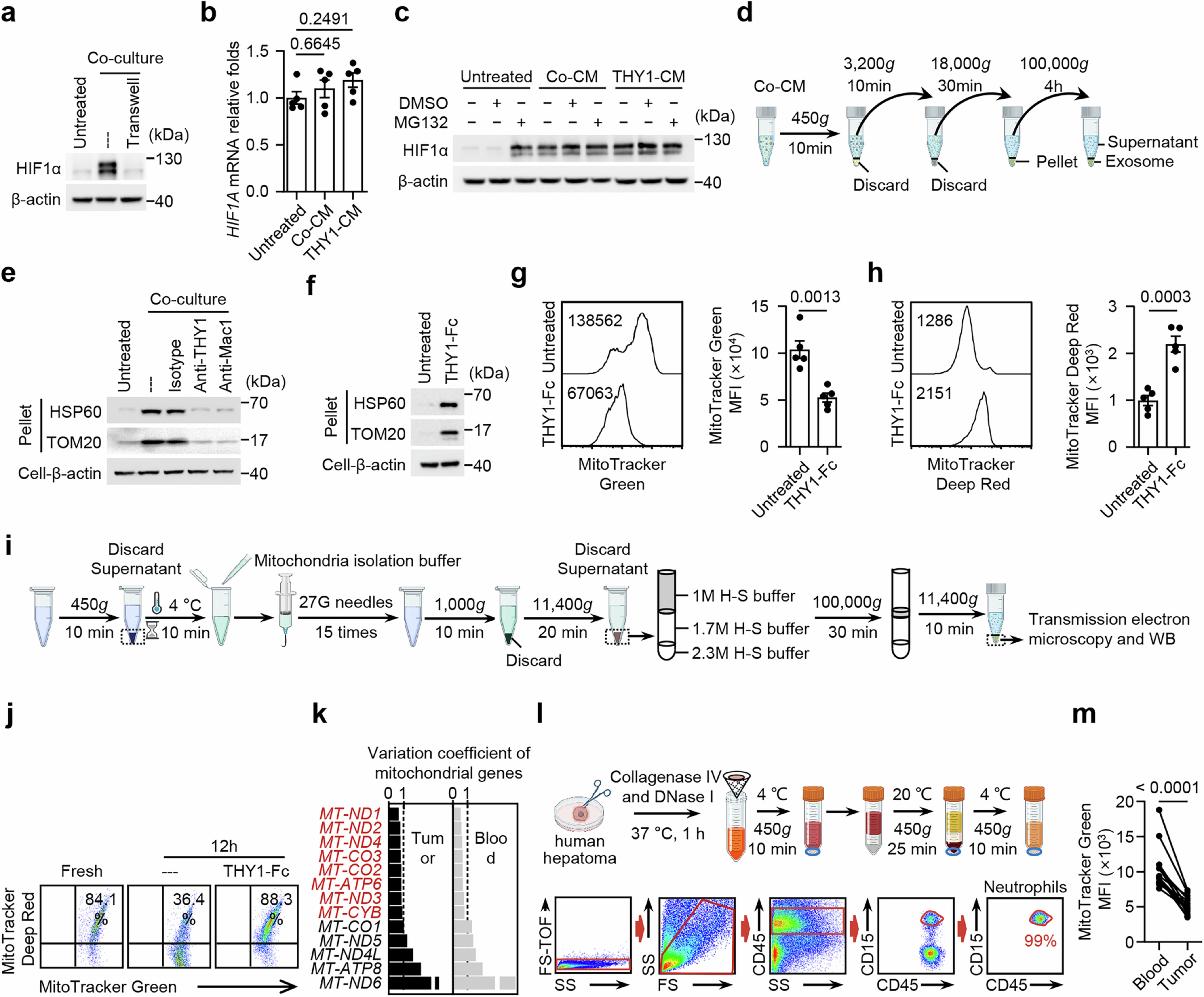 Extended Data Fig. 6: THY1 signalling promote ROS-enriched mitochondria extrusion by neutrophils.
