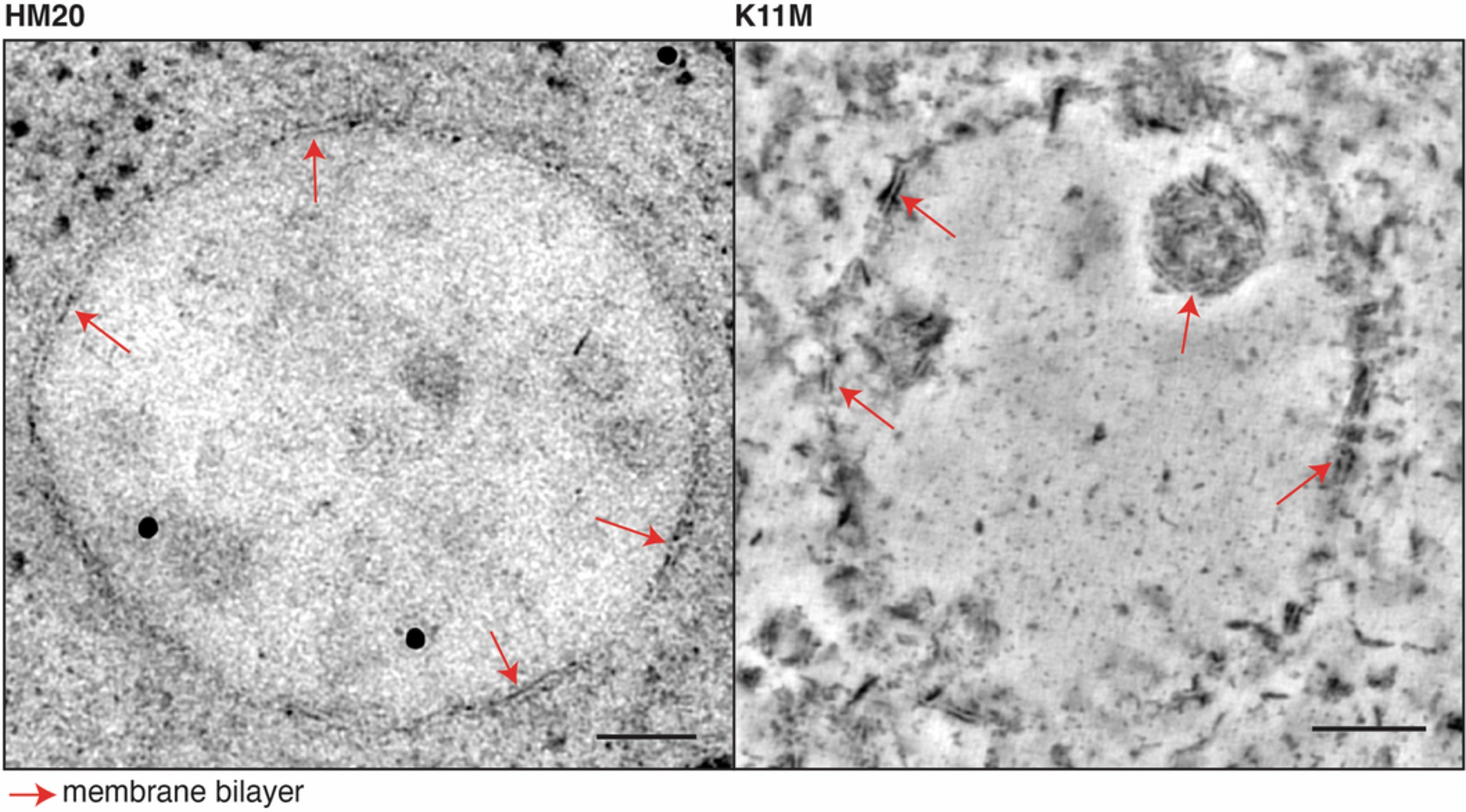 Extended Data Fig. 6: Preservation of membrane ultrastructure in different resins.