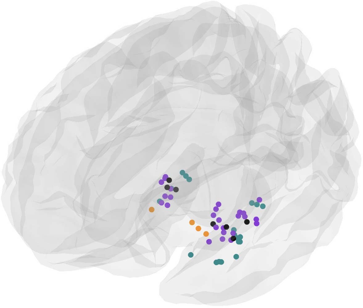 Extended Data Fig. 7: Location of stimulation electrodes.