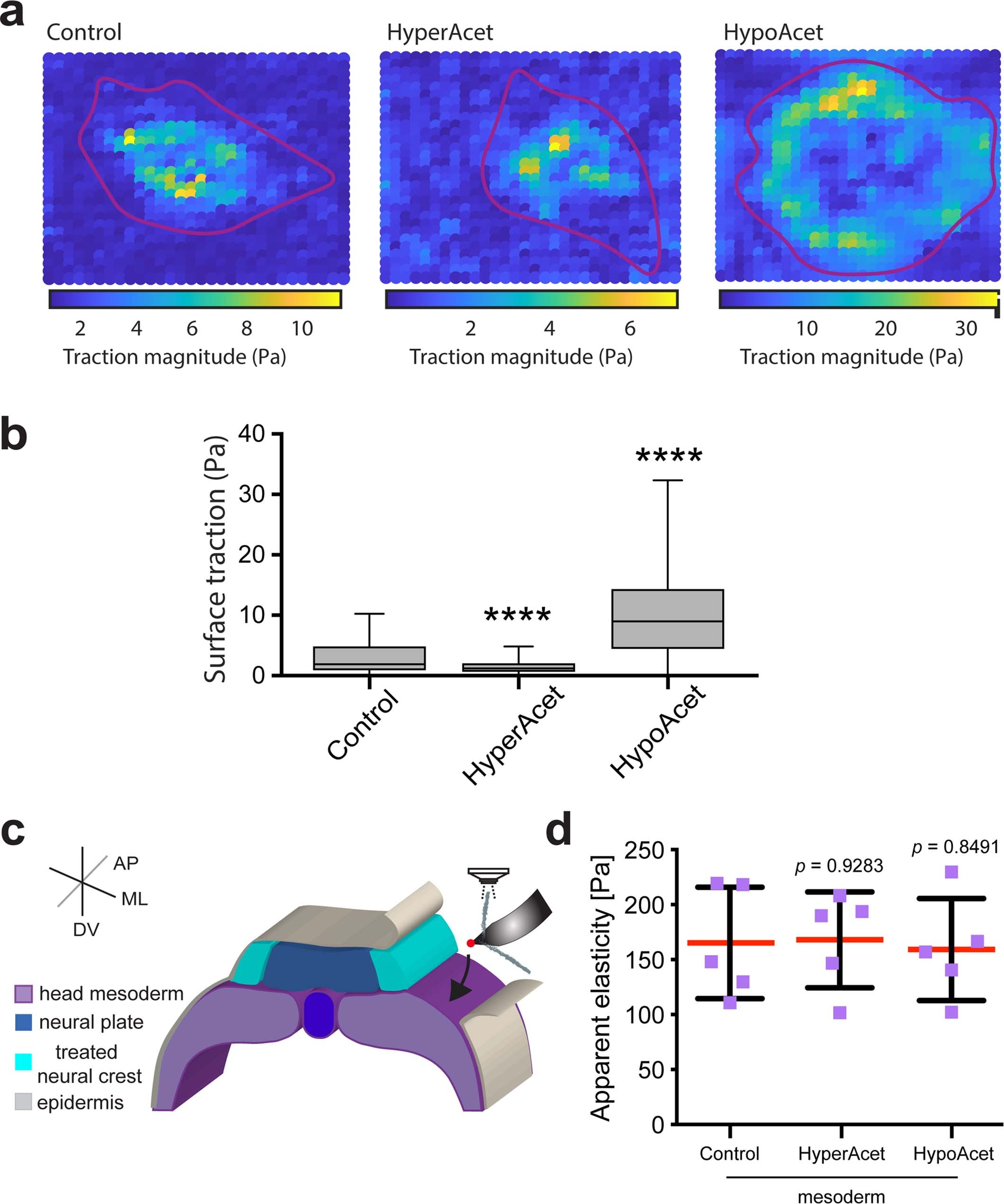 Extended Data Fig. 8: Impact of NC microtubule acetylation in traction force and mesoderm stiffness.