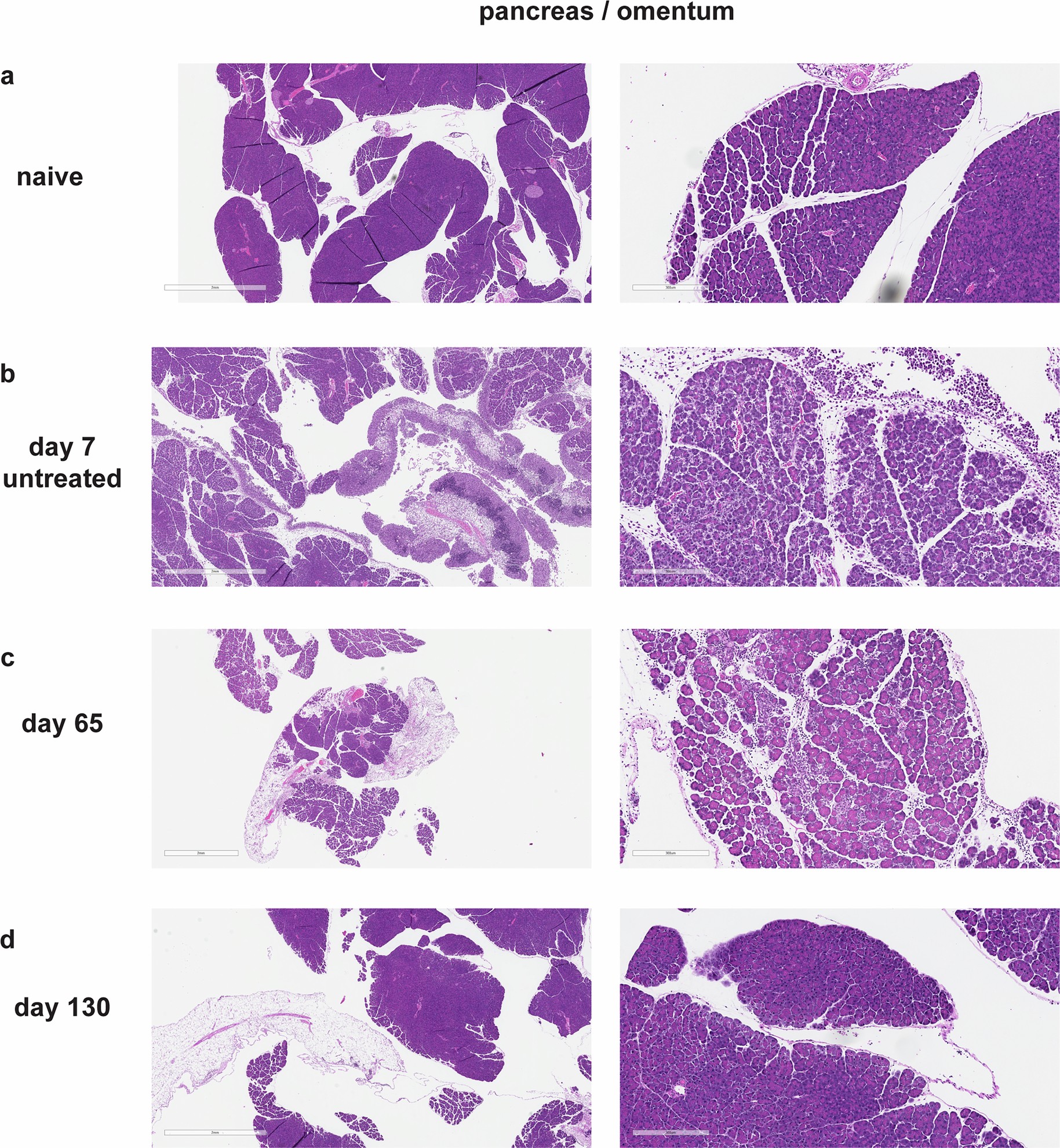 Extended Data Fig. 10: The combination of Mal-LbL NPs with CPI shows tumor clearance and recovery (day 130) of pancreatic findings.