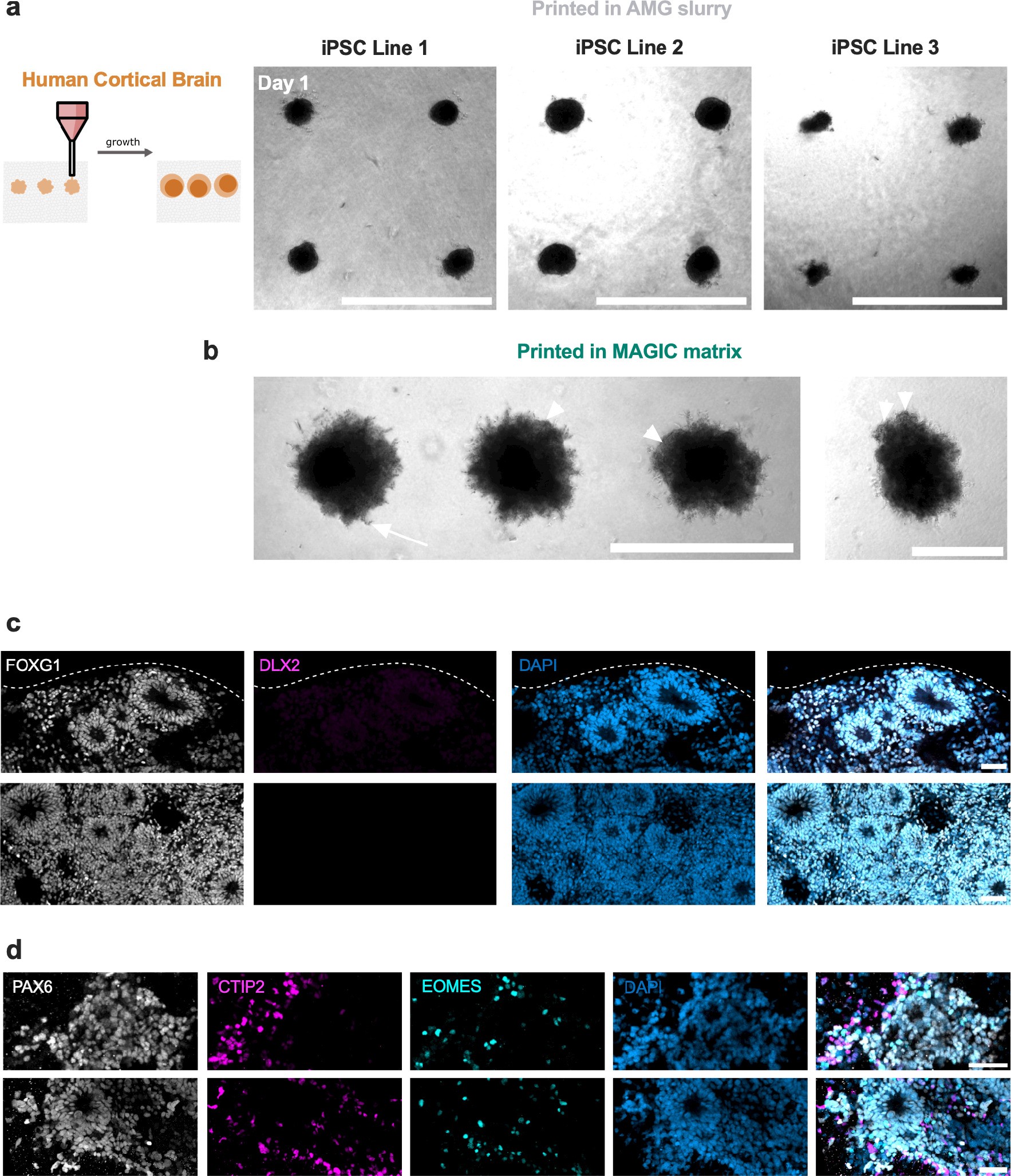 Extended Data Fig. 6: Bioprinted hiPSC-derived cortical brain organoids exhibit matrix-dependent phenotypes and rosette organization.