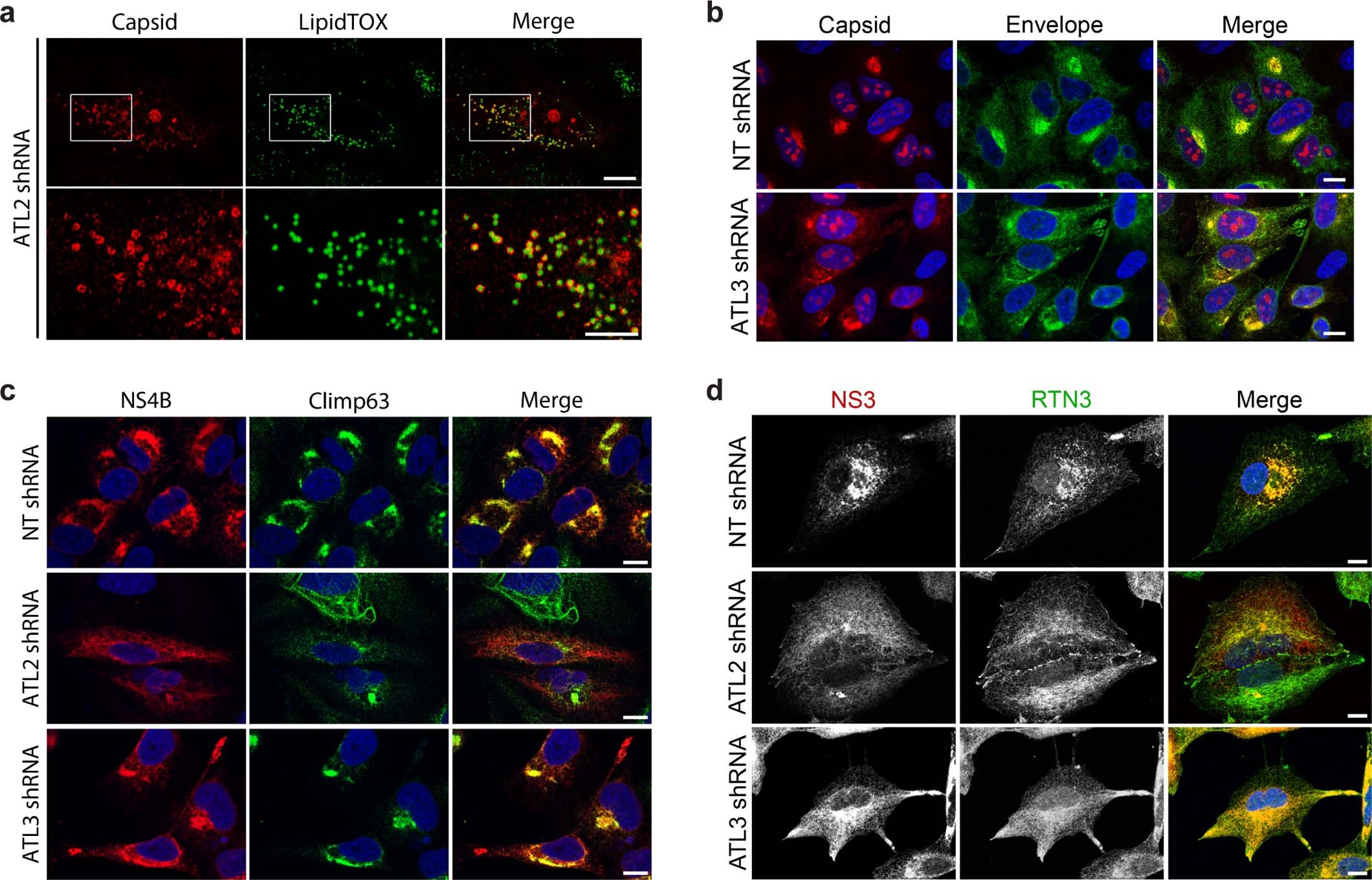 Extended Data Fig. 2: Virus protein localization in ATL depleted cells.