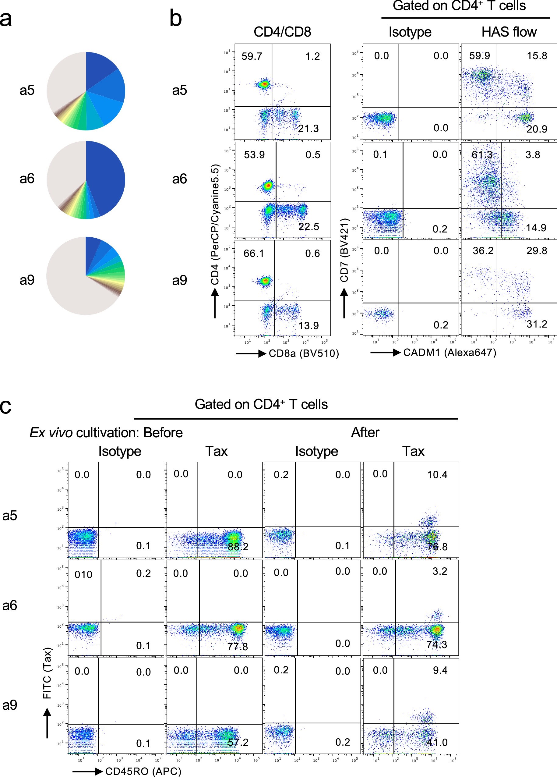 Extended Data Fig. 7: Characteristics of three smoldering ATL (smATL) cases.