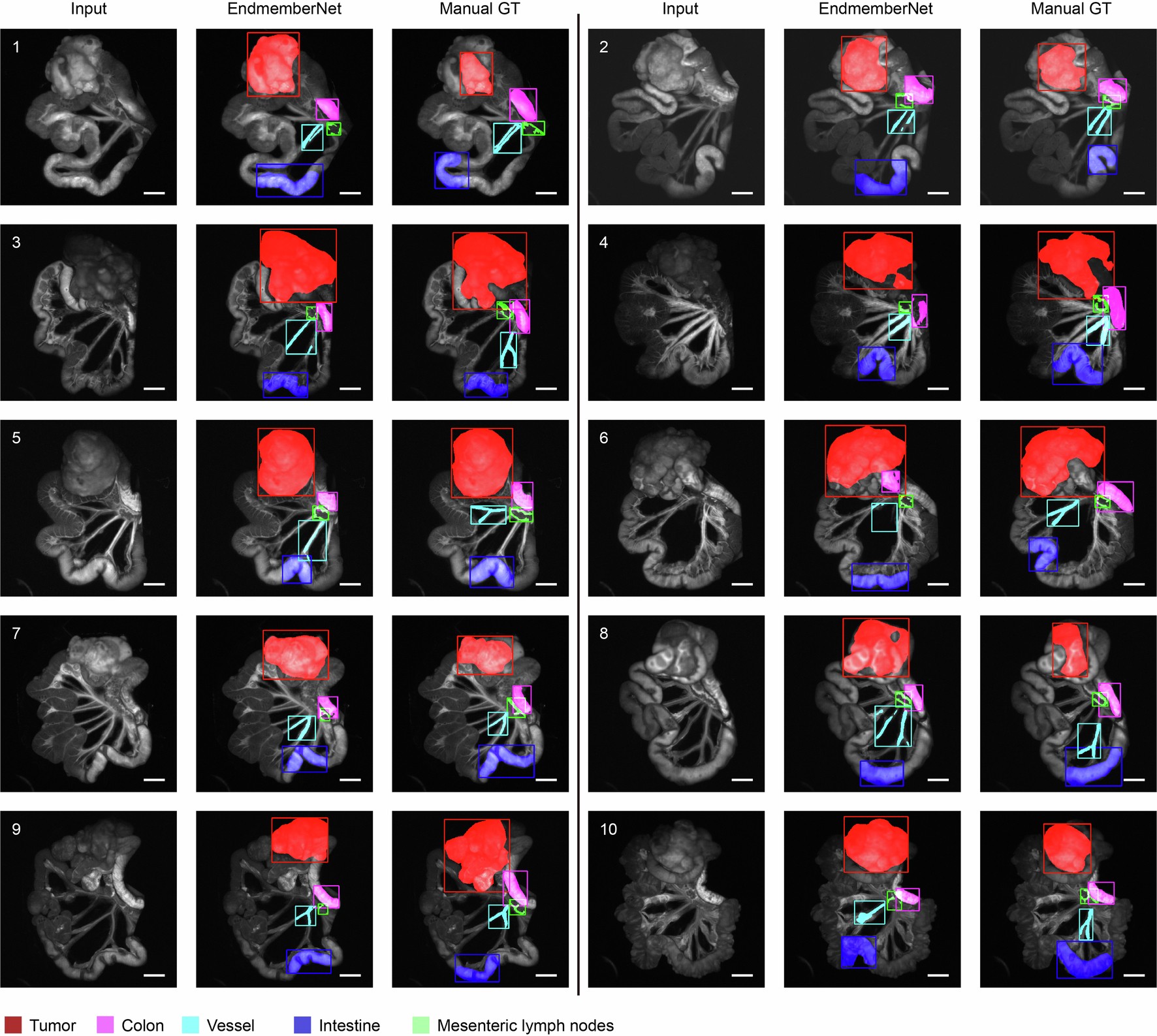 Extended Data Fig. 6: Qualitative results of the predicted bounding boxes and segmentation by EndmemberNet using manual processing as ground truth.