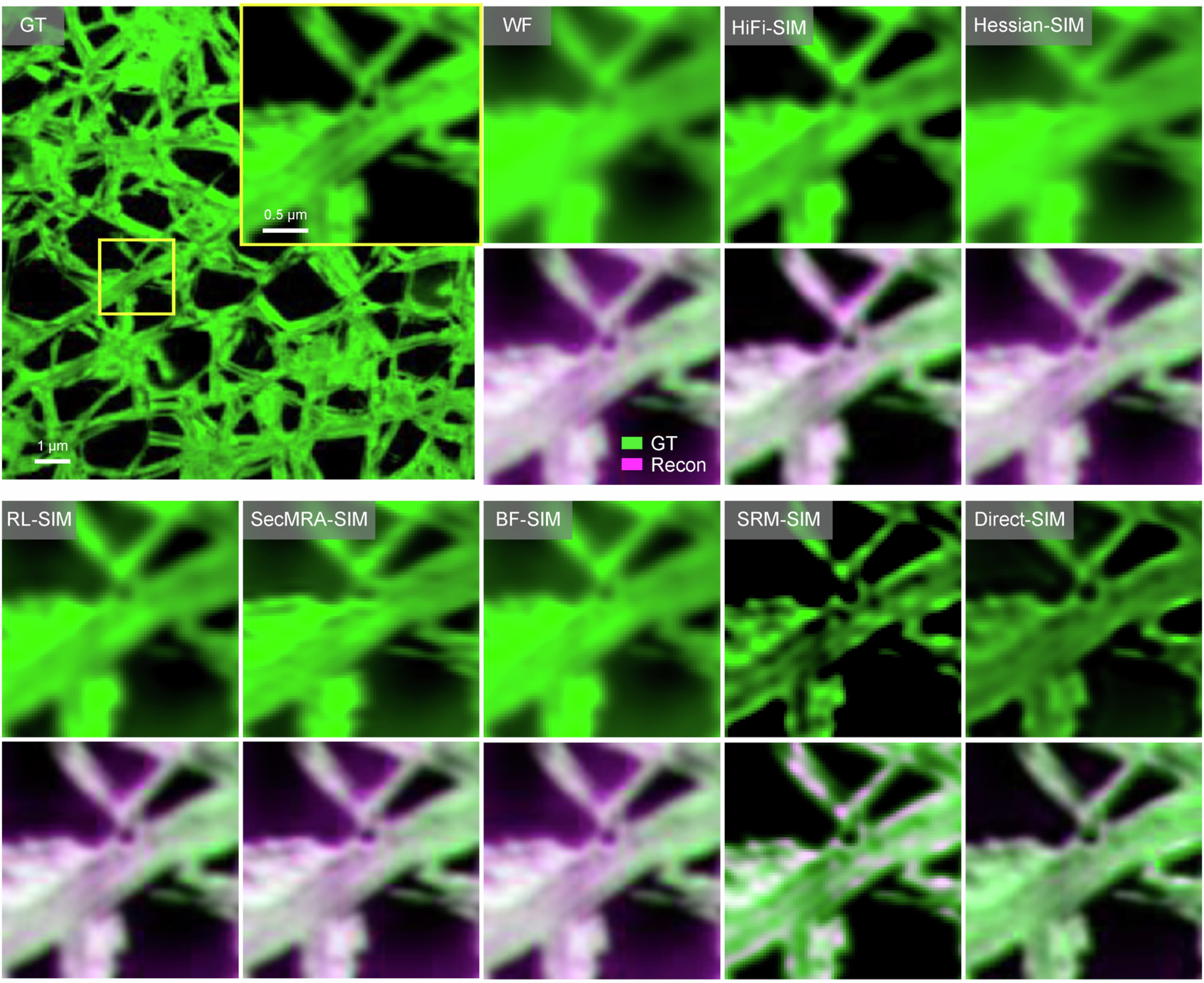 Extended Data Fig. 1: Simulation results of WF and the other 7 SR-SIM reconstruction algorithms.