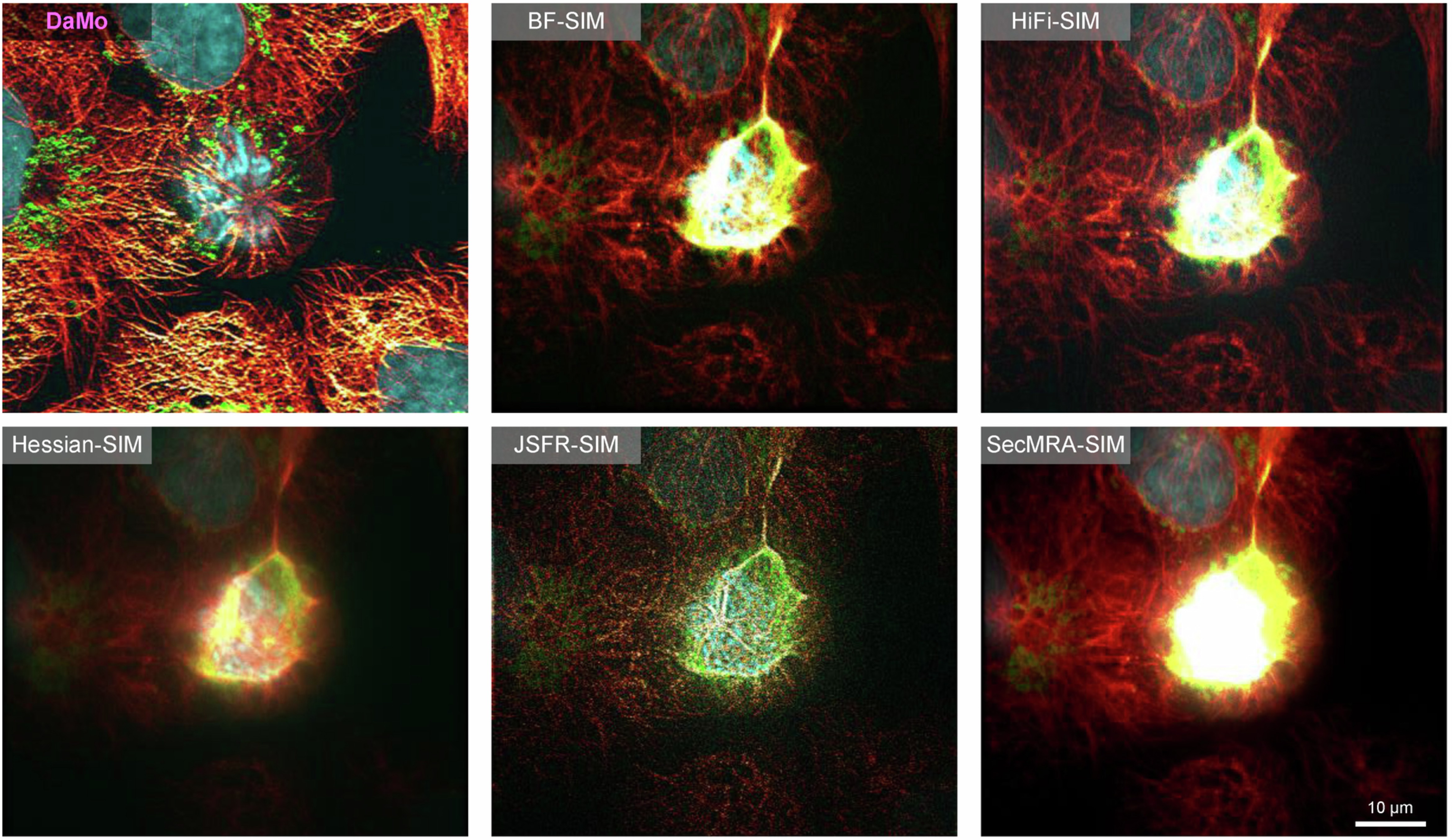 Extended Data Fig. 3: Algorithm comparison on the same mitotic cell.