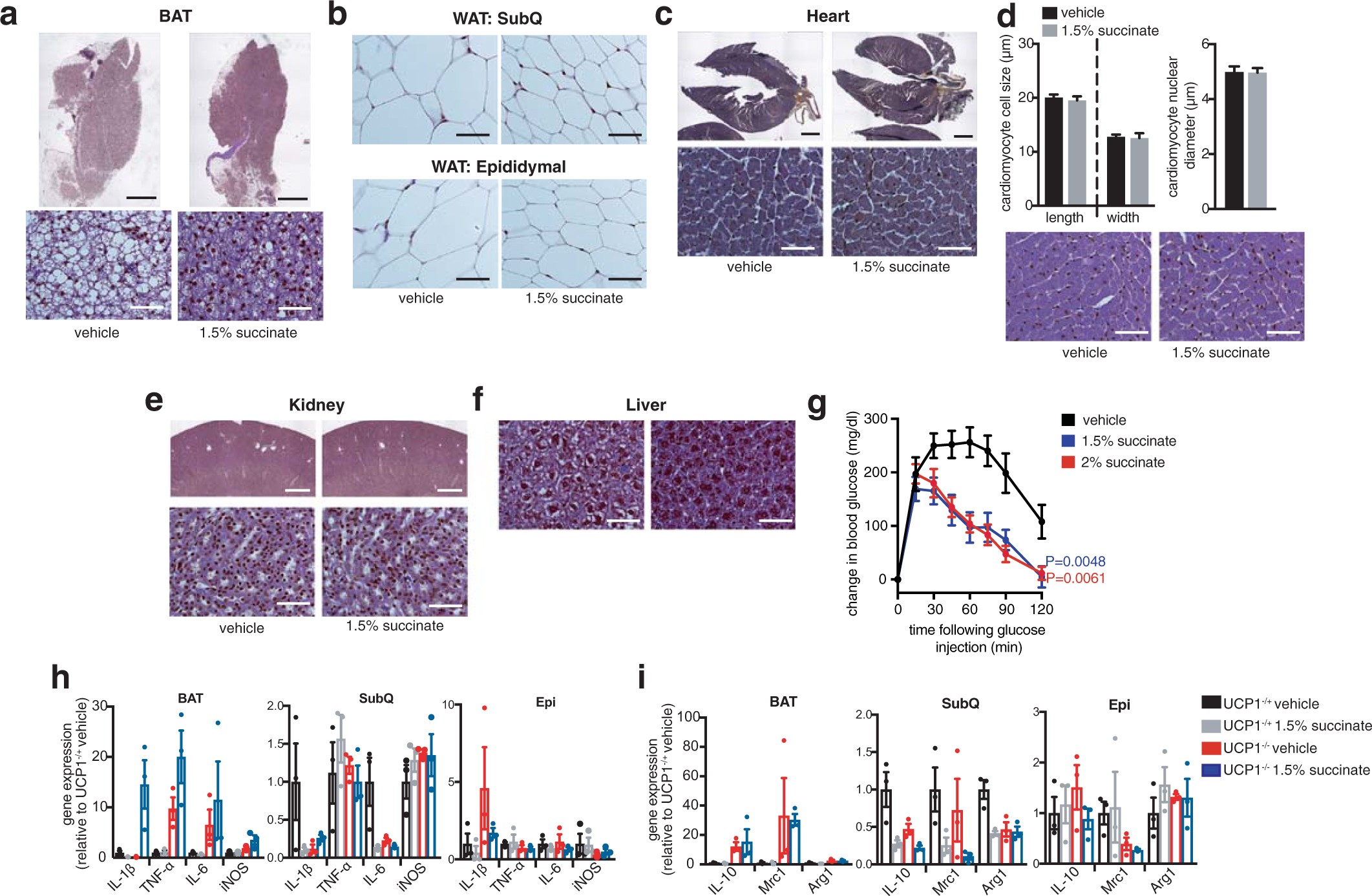Extended Data Fig. 9: Assessment of morphologic effects of systemic succinate administration on mouse tissues.
