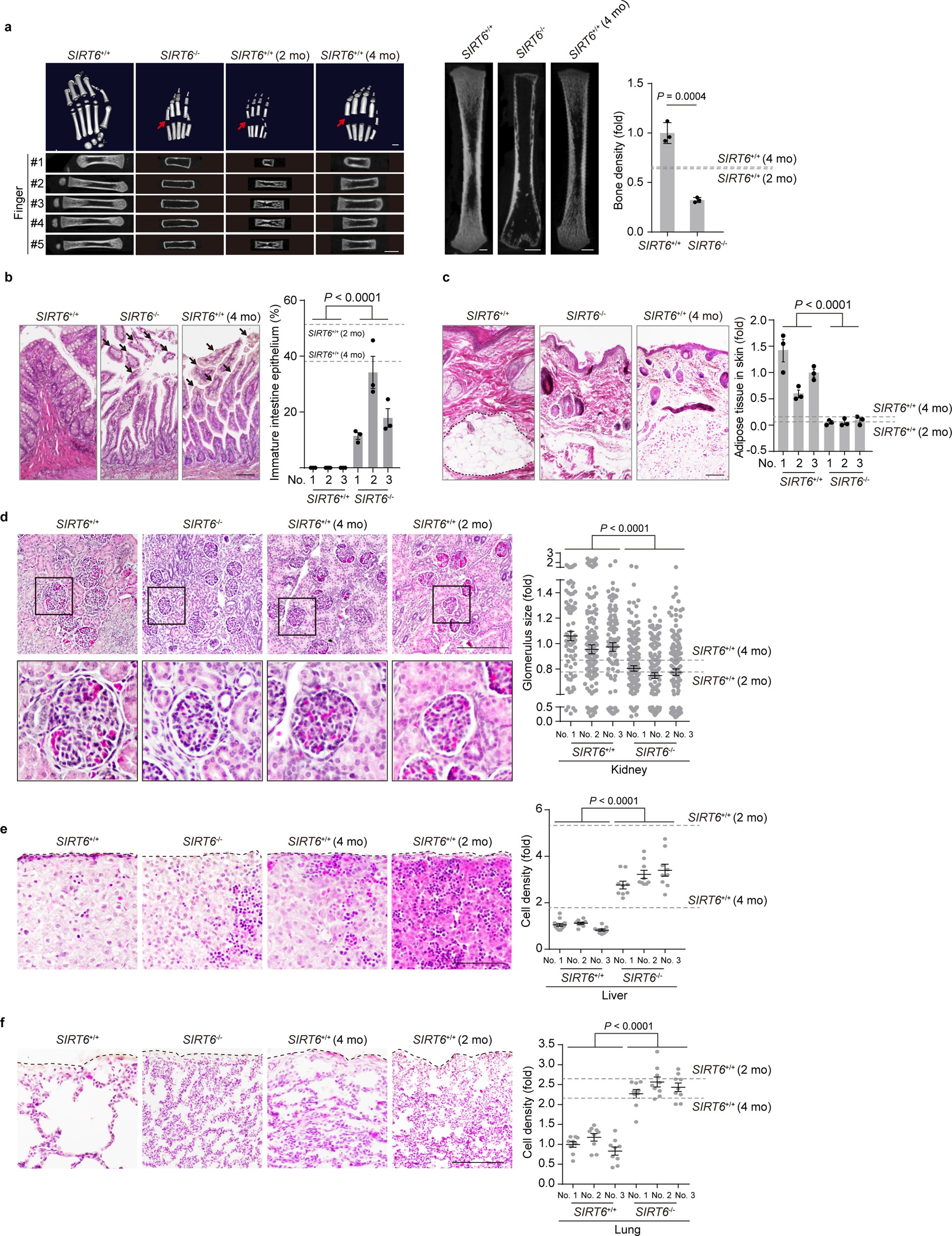 Extended Data Fig. 4: SIRT6 deficiency resulted in a pan-tissue developmental delay.