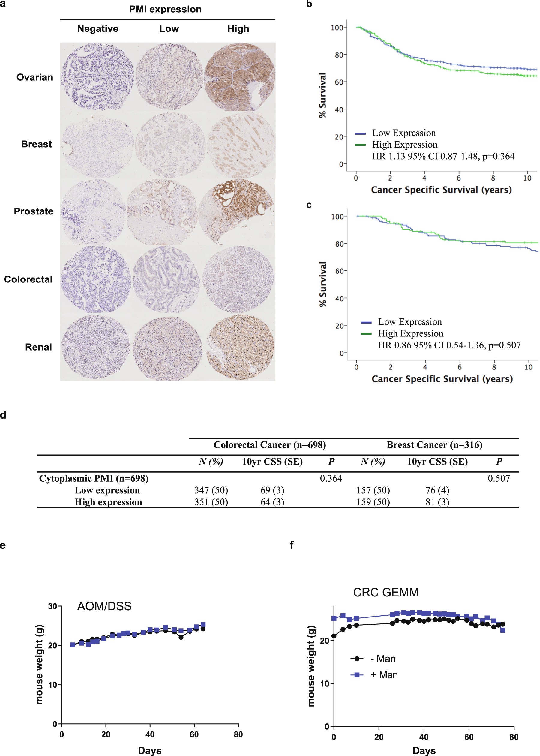 Extended Data Fig. 9: PMI levels vary in human tumours, but do not predict overall survival and the weight of mice is not affected by mannose treatment in models of colorectal cancer.