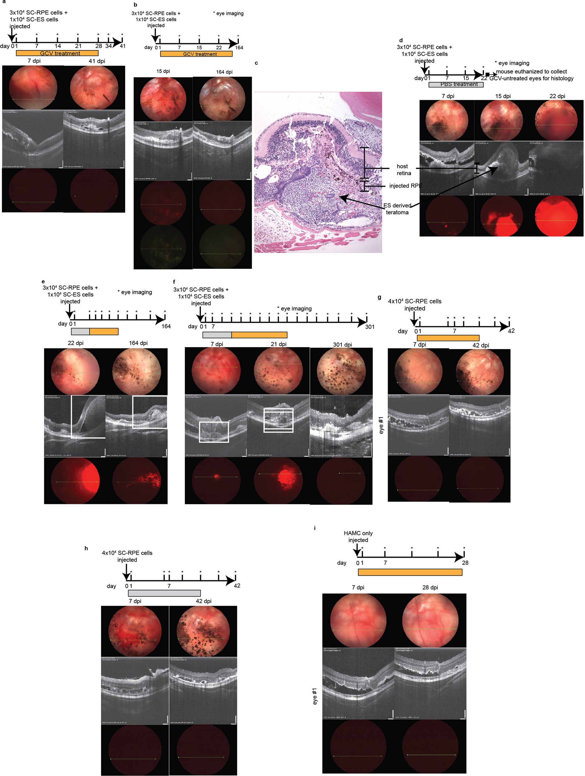 Extended Data Fig. 10: Representative images of eyes transplanted with both safe-cell RPE and safe-cell ES cells, and only with safe-cell RPE cells.
