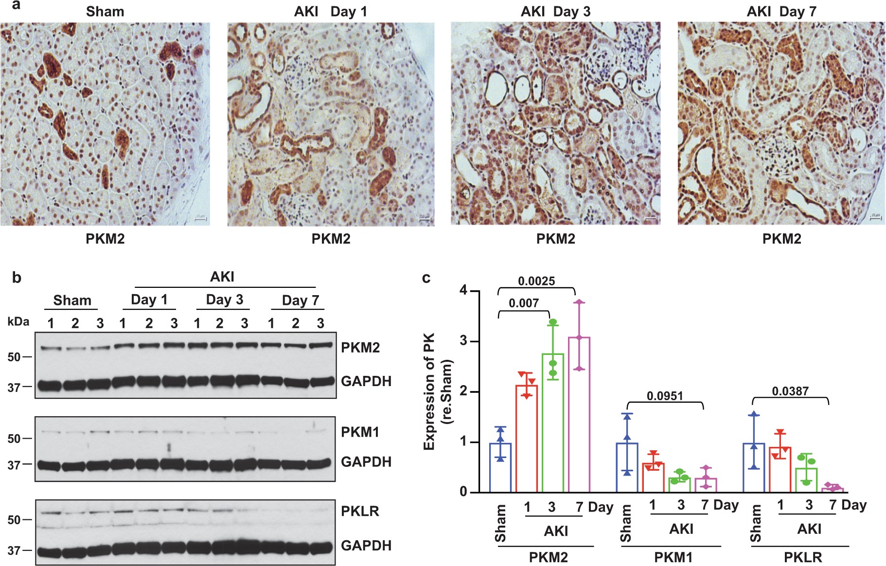 Extended Data Fig. 10: Expression of PKM1, PKM2 and PKLR after AKI.