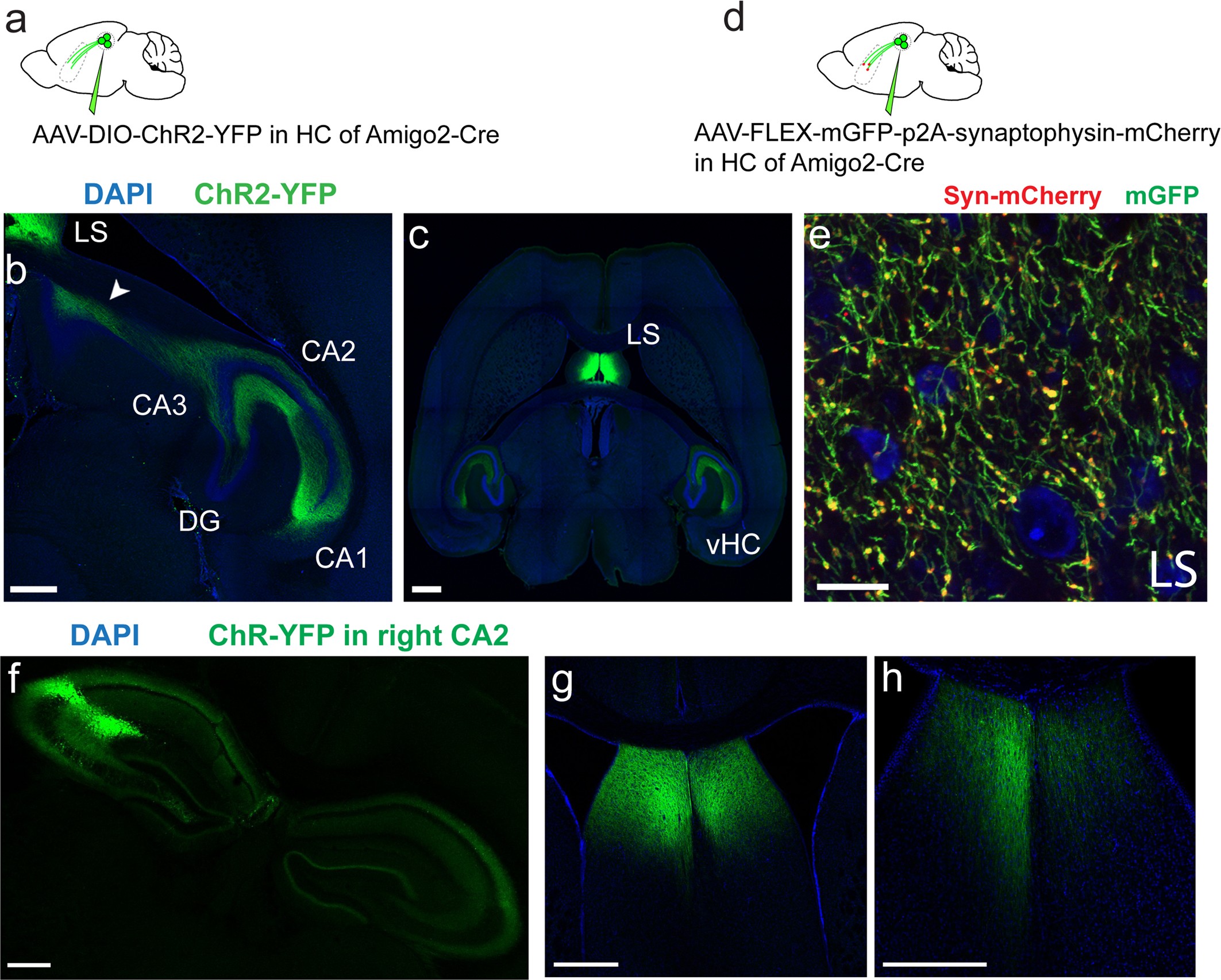 Extended Data Fig. 1: CA2 projections to LS.