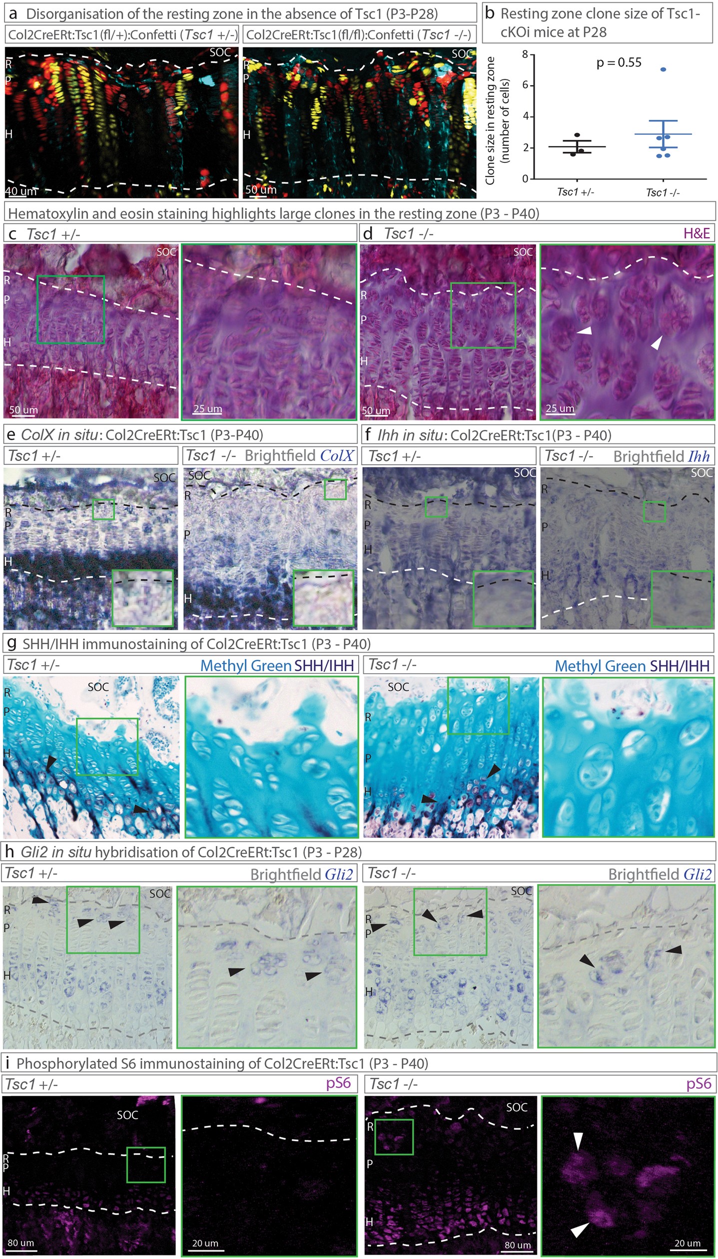 Extended Data Fig. 8: Postnatal cartilage-specific Tsc1 ablation does not promote hypertrophic differentiation in the resting zone.