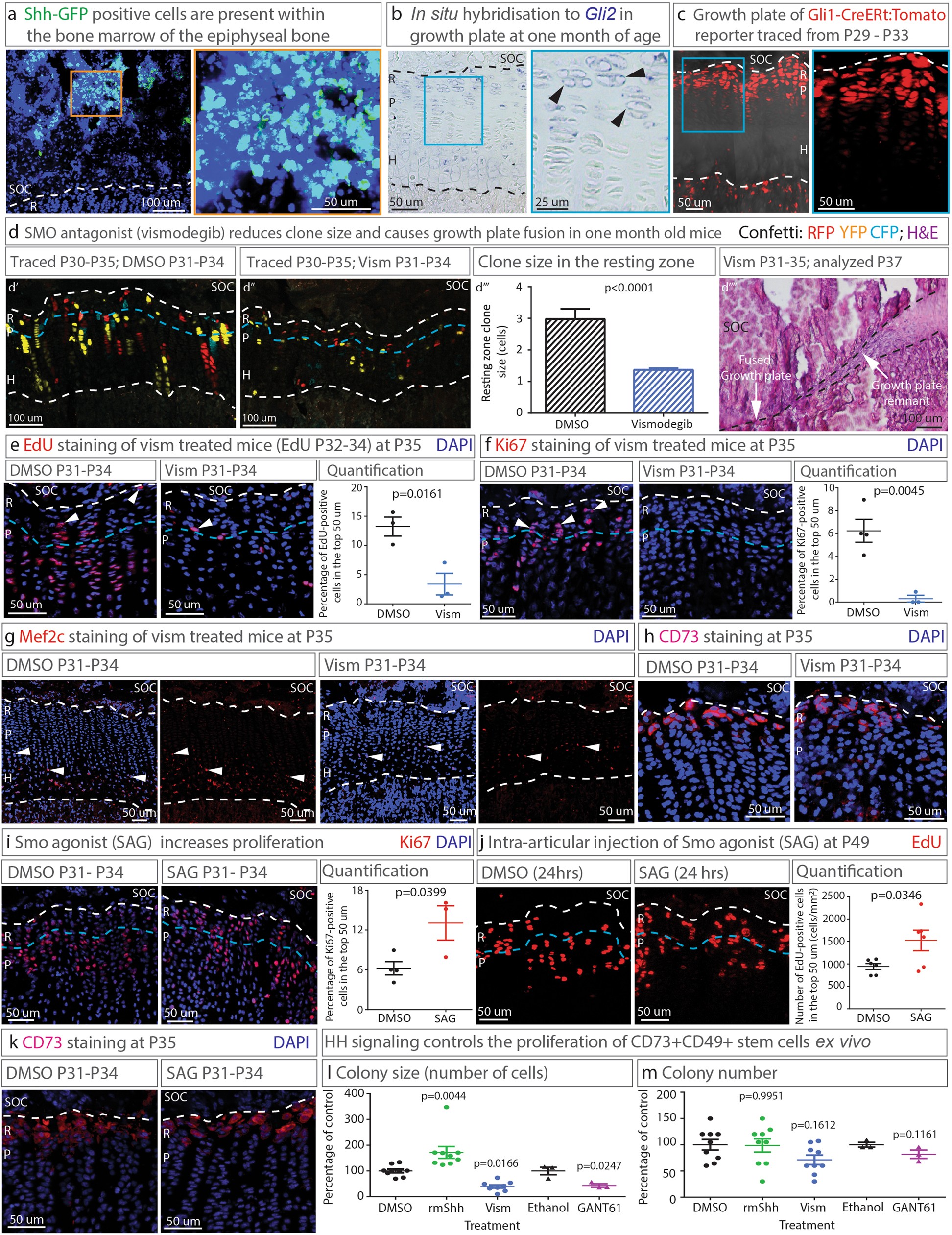 Extended Data Fig. 6: Indications that hedgehog signalling controls stem cell renewal in the epiphyseal niche.