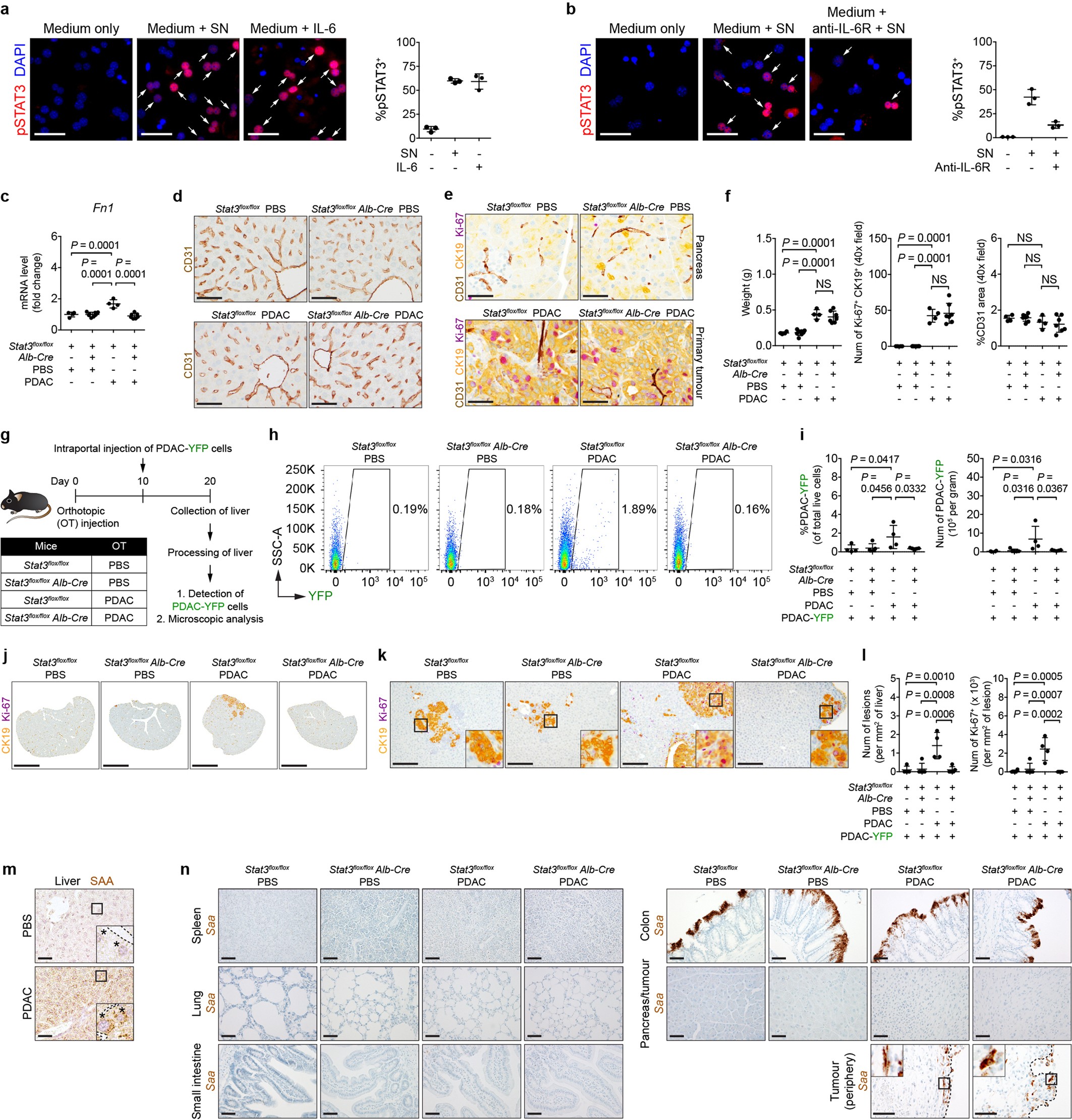Extended Data Fig. 6: STAT3 signalling in hepatocytes promotes the formation of a pro-metastatic niche in the liver.