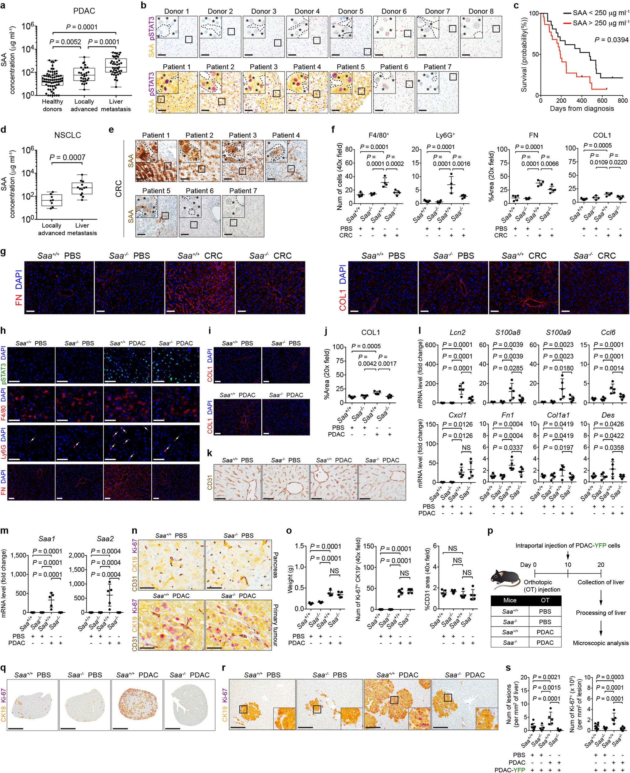 Extended Data Fig. 7: SAA promotes the formation of a pro-metastatic niche in the liver.