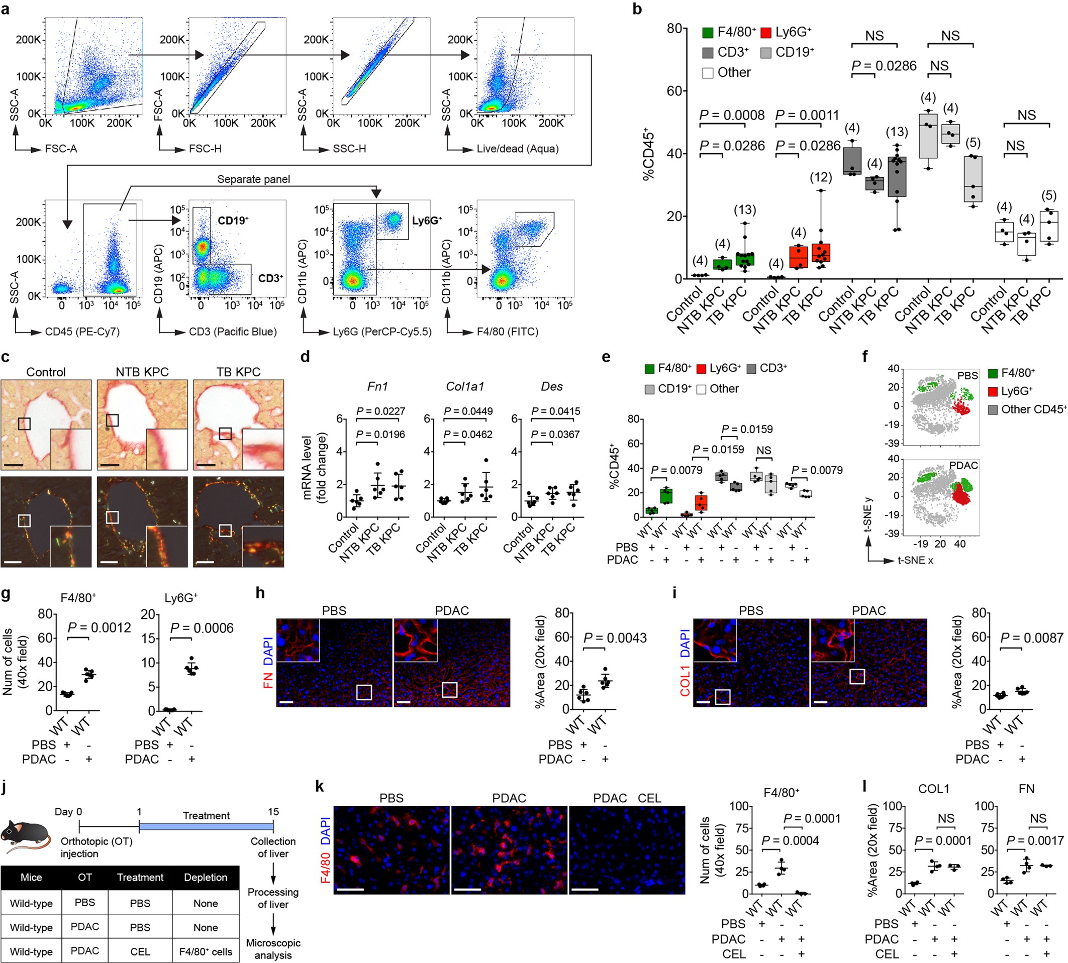 Extended Data Fig. 1: Primary PDAC development induces myeloid cell accumulation and fibrosis within the liver.