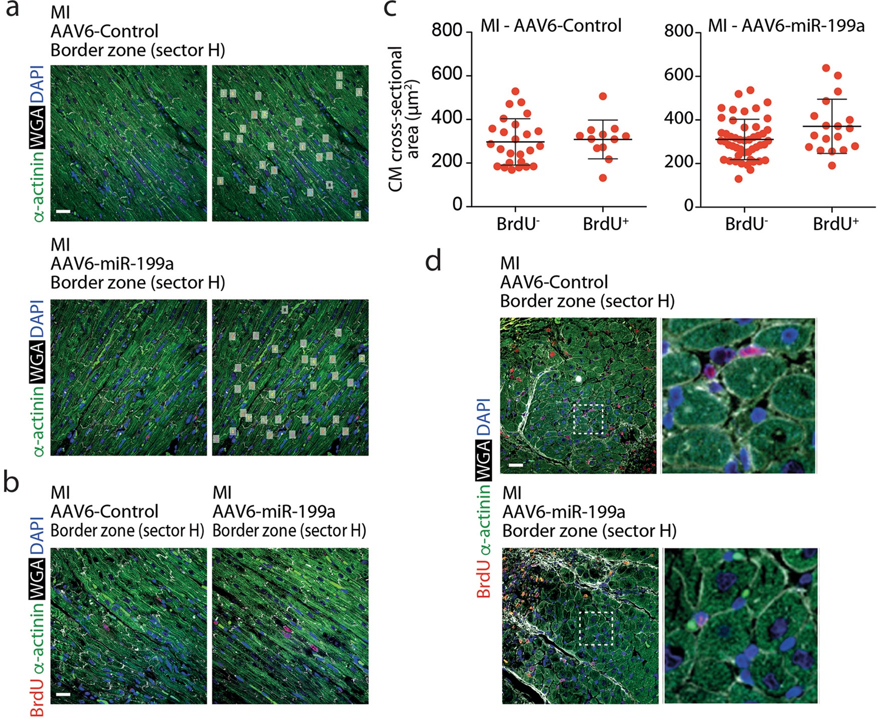 Extended Data Fig. 6: Multinucleation and cardiomyocyte hypertrophy in miR-199a-treated pig hearts.