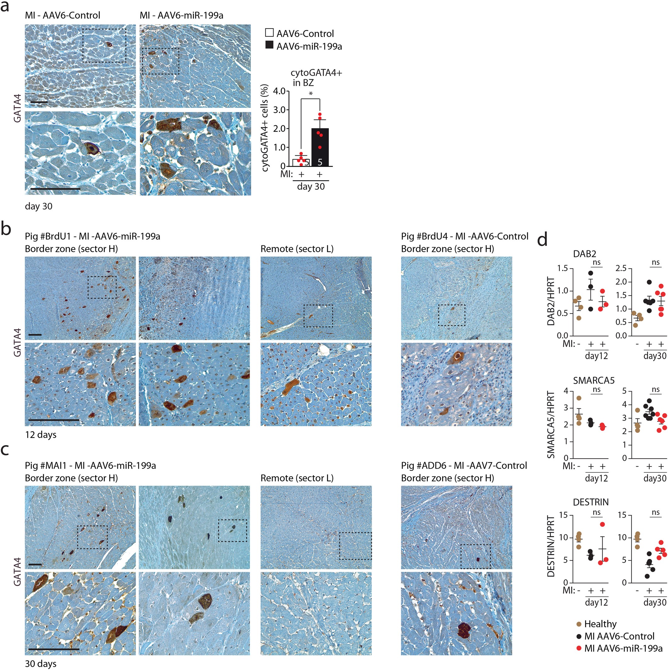 Extended Data Fig. 7: Expression of GATA4 in cardiomyocytes in the infarct border zone of AAV6-miR-199a-treated pigs.