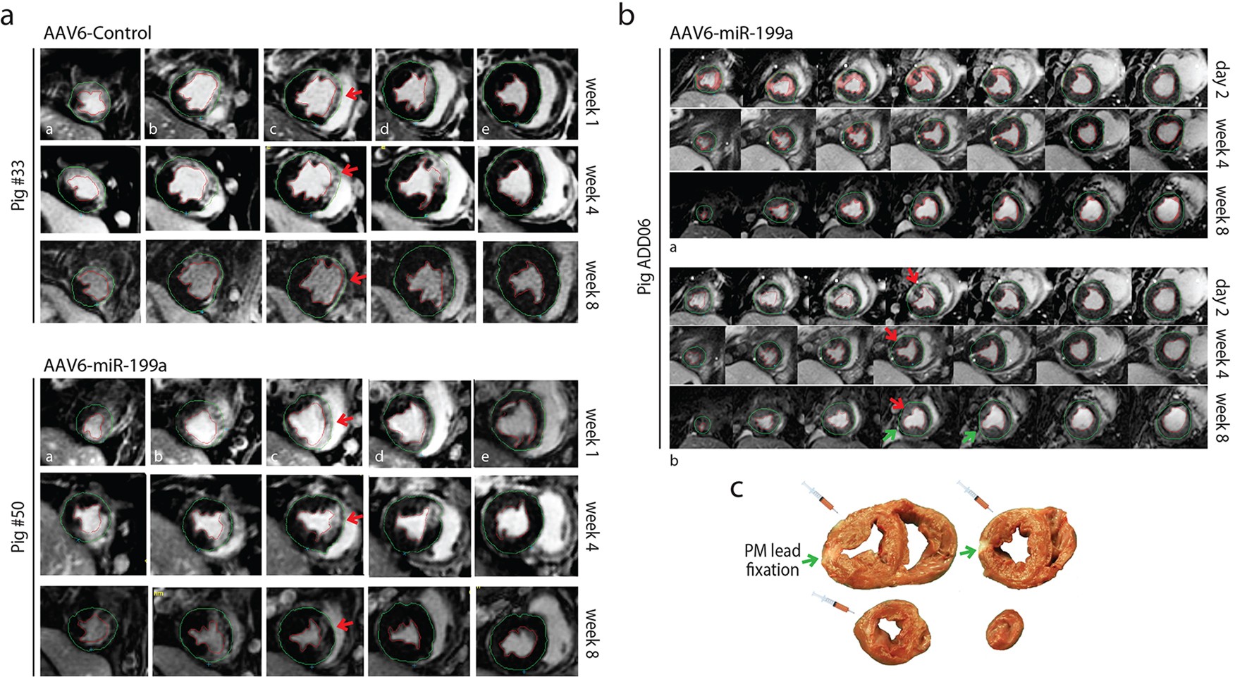 Extended Data Fig. 9: Long-term expression of miR-199a induces progressive cardiac regeneration.