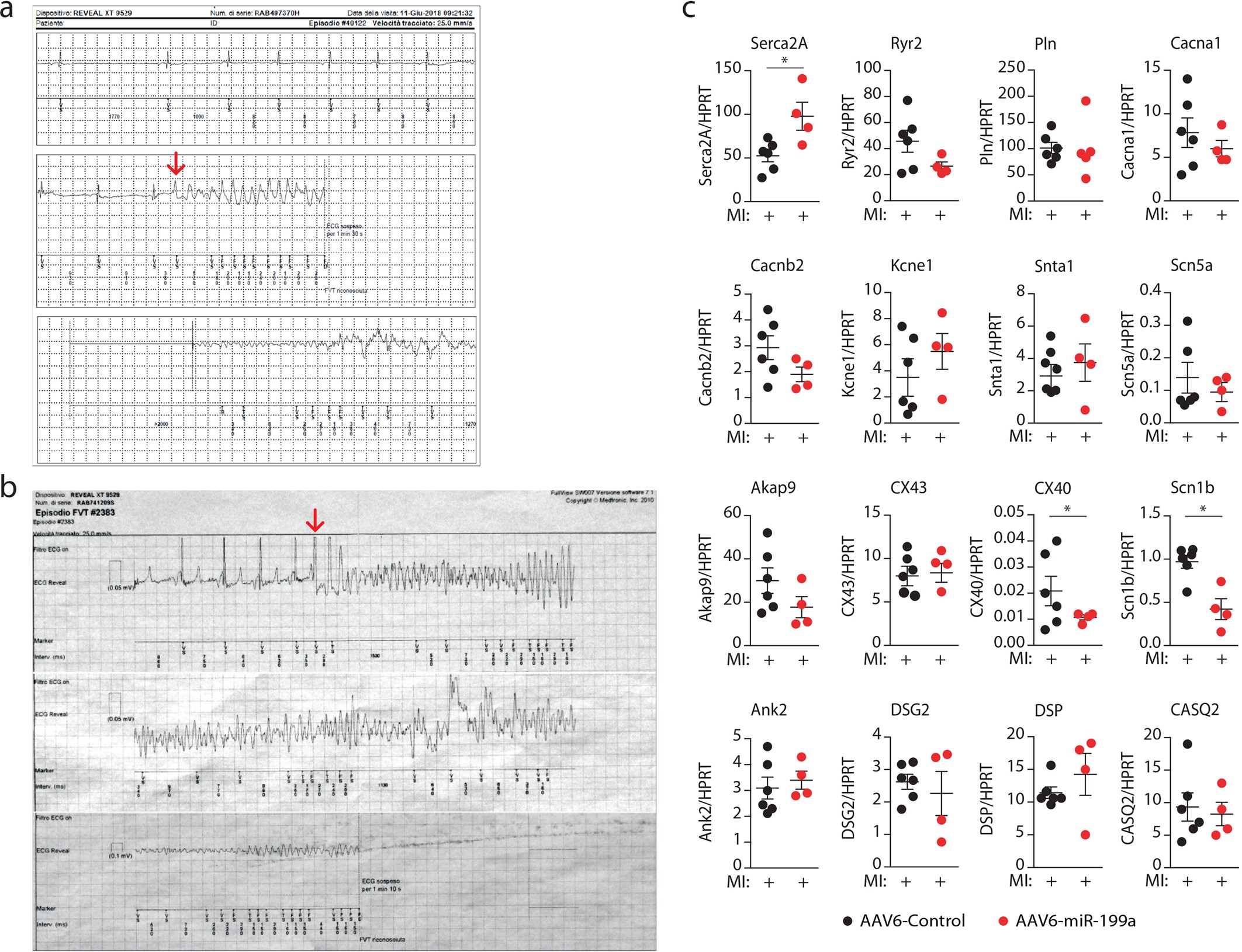 Extended Data Fig. 10: Recording of fatal arrhythmias in two infarcted pigs treated with AAV6-miR-199a-3p.