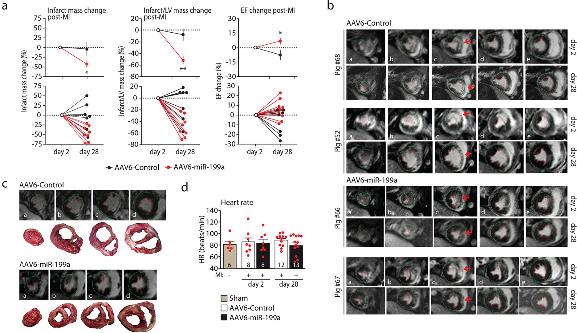 Extended Data Fig. 4: miR-199a improves global heart function and decreases infarct mass one month after treatment.