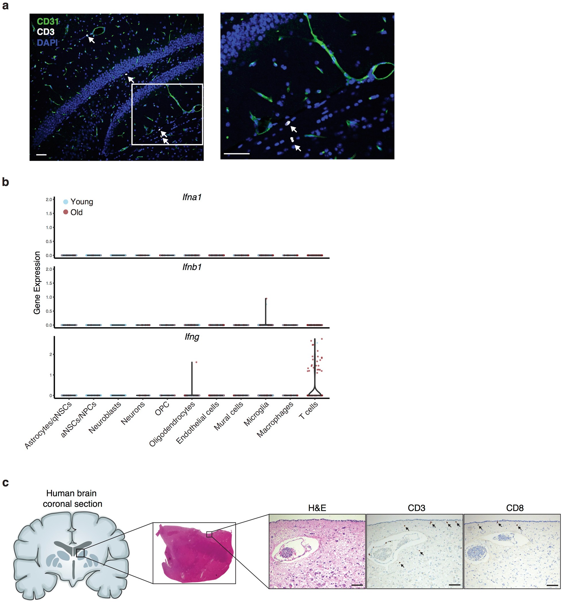 Extended Data Fig. 2: T cells in old brains are within the brain parenchyma and express Ifng.