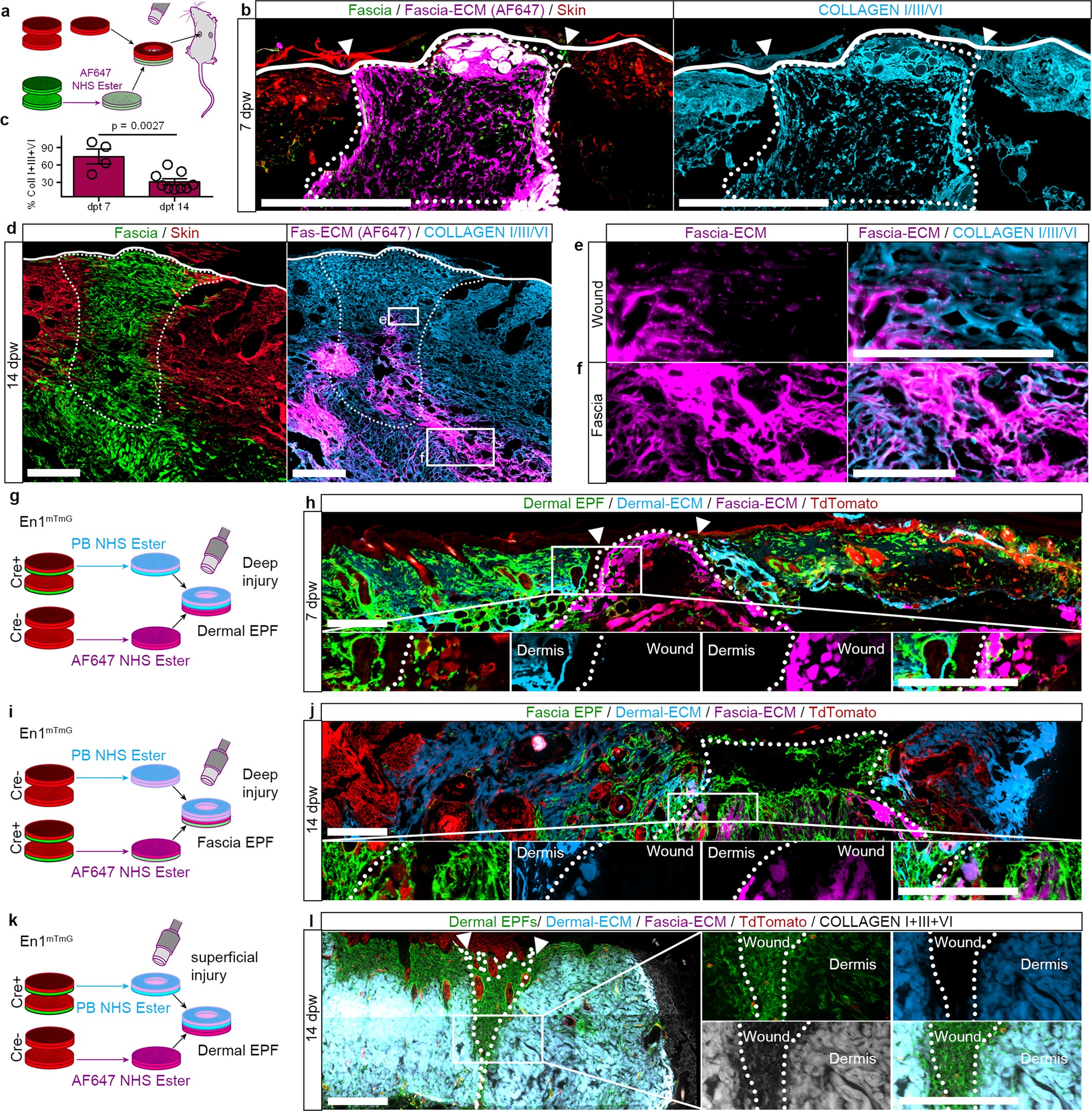 Extended Data Fig. 6: Fascia but not dermal matrix steers into wounds.