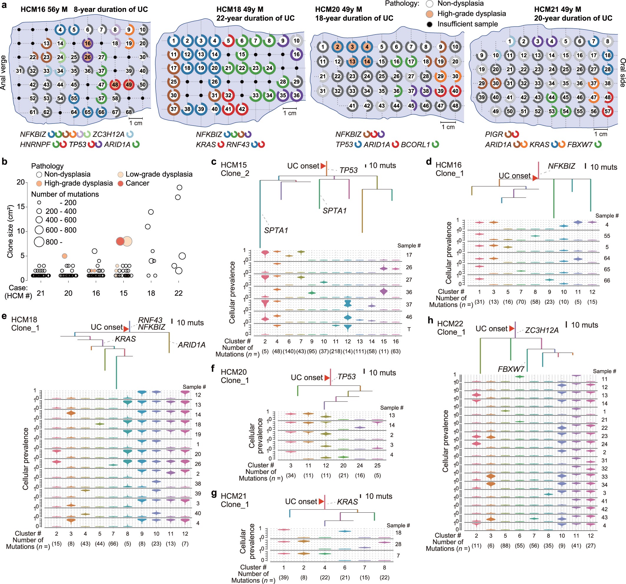 Extended Data Fig. 7: Clonal expansion in UC rectums.