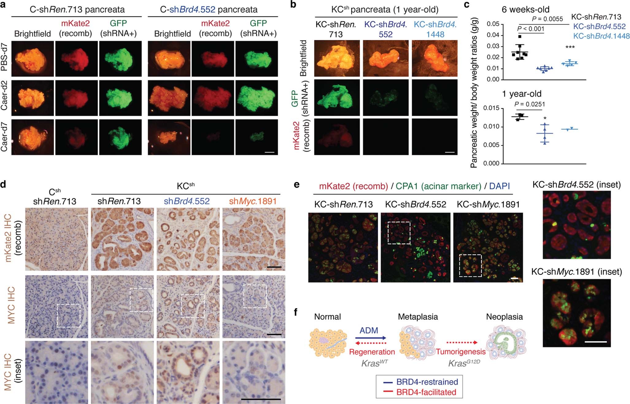 Extended Data Fig. 5: BRD4 suppression impairs regenerative and neoplastic fate outcomes of injury-driven pancreas plasticity.