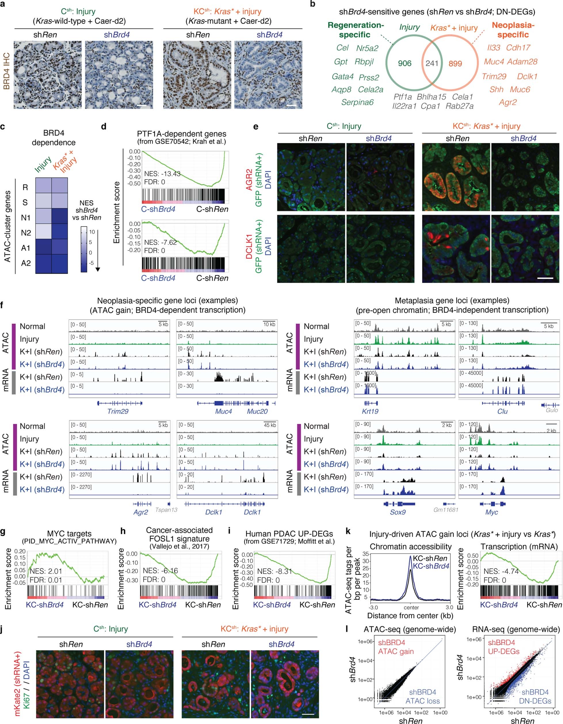 Extended Data Fig. 6: BRD4 suppression reveals distinct chromatin-associated transcriptional programs in normal versus Kras-mutant injured pancreases.