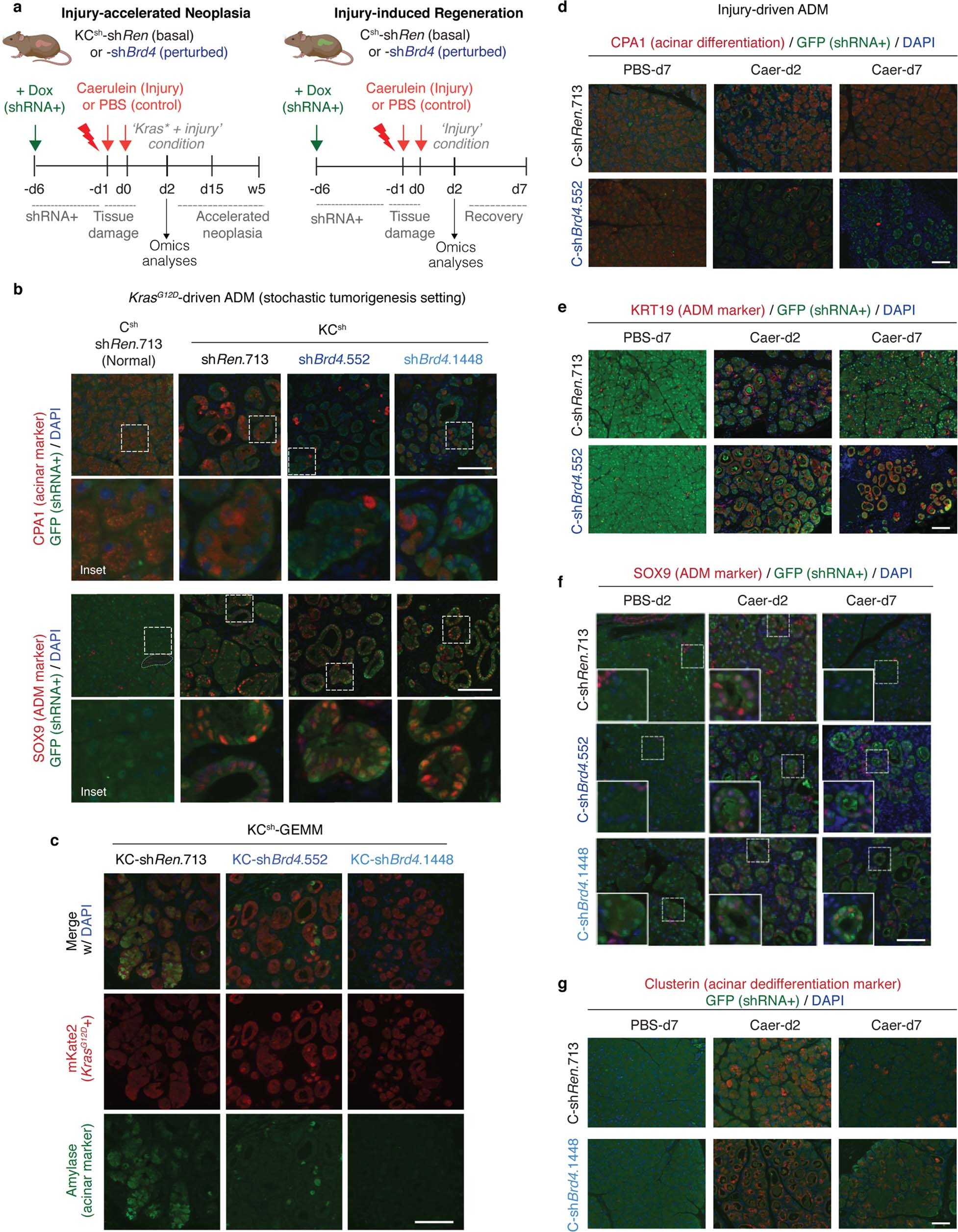 Extended Data Fig. 4: BRD4 suppression is dispensable for both regenerative and pre-neoplastic ADM.