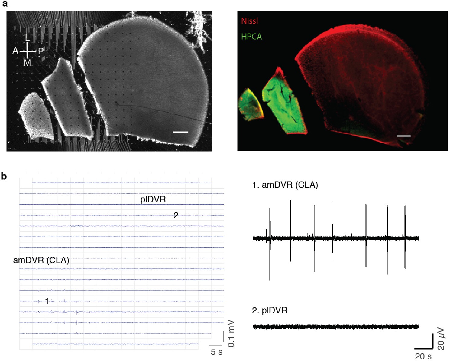Extended Data Fig. 4: Mini-slices of the DVR and localization of SWR generation.
