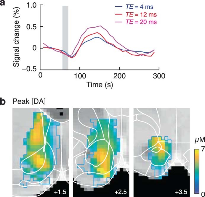 Extended Data Fig. 3: Baseline correction of dopamine fMRI data using T2*-dependent signals.