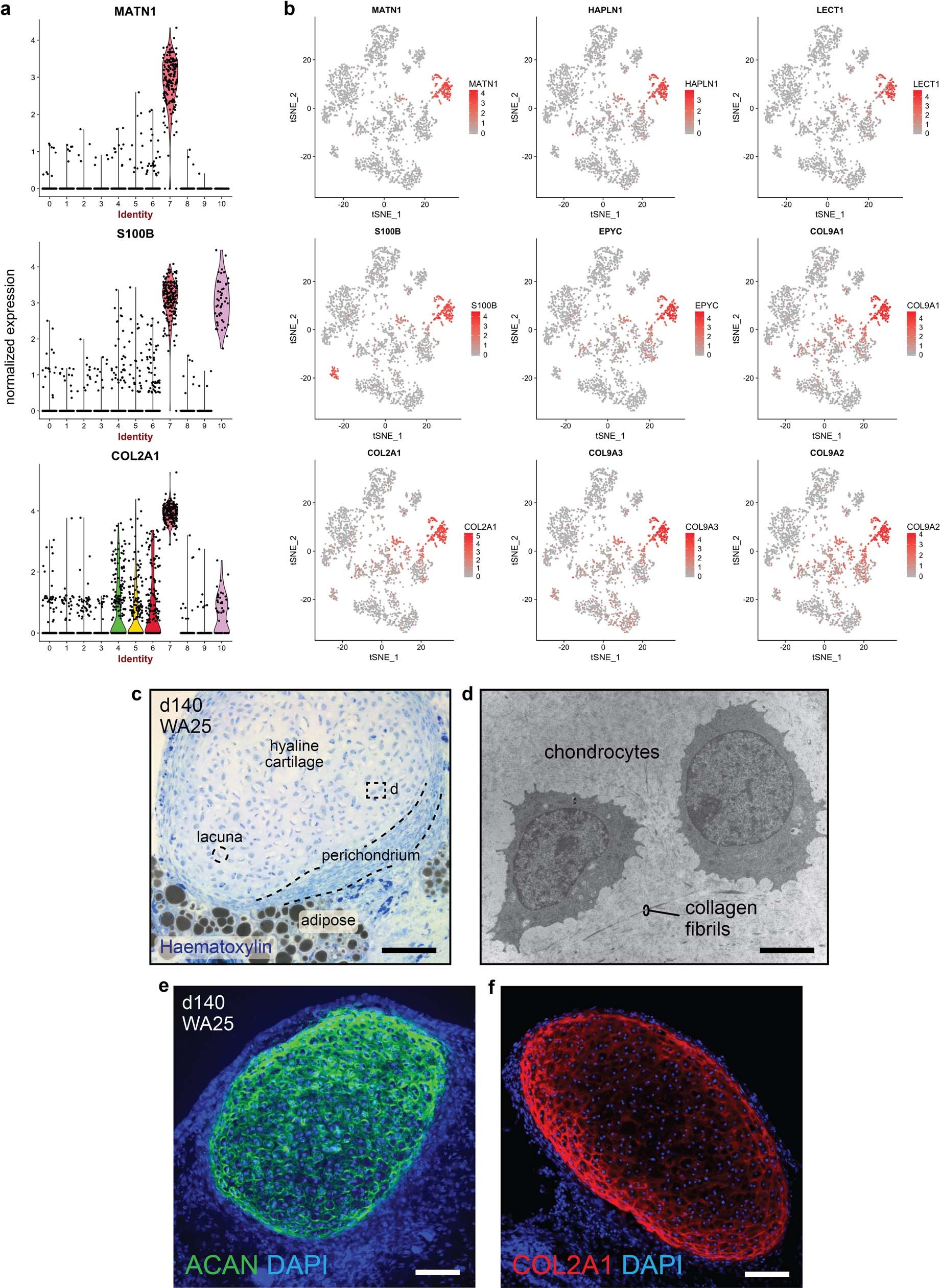 Extended Data Fig. 8: Chondral development in the tail region of skin organoids.