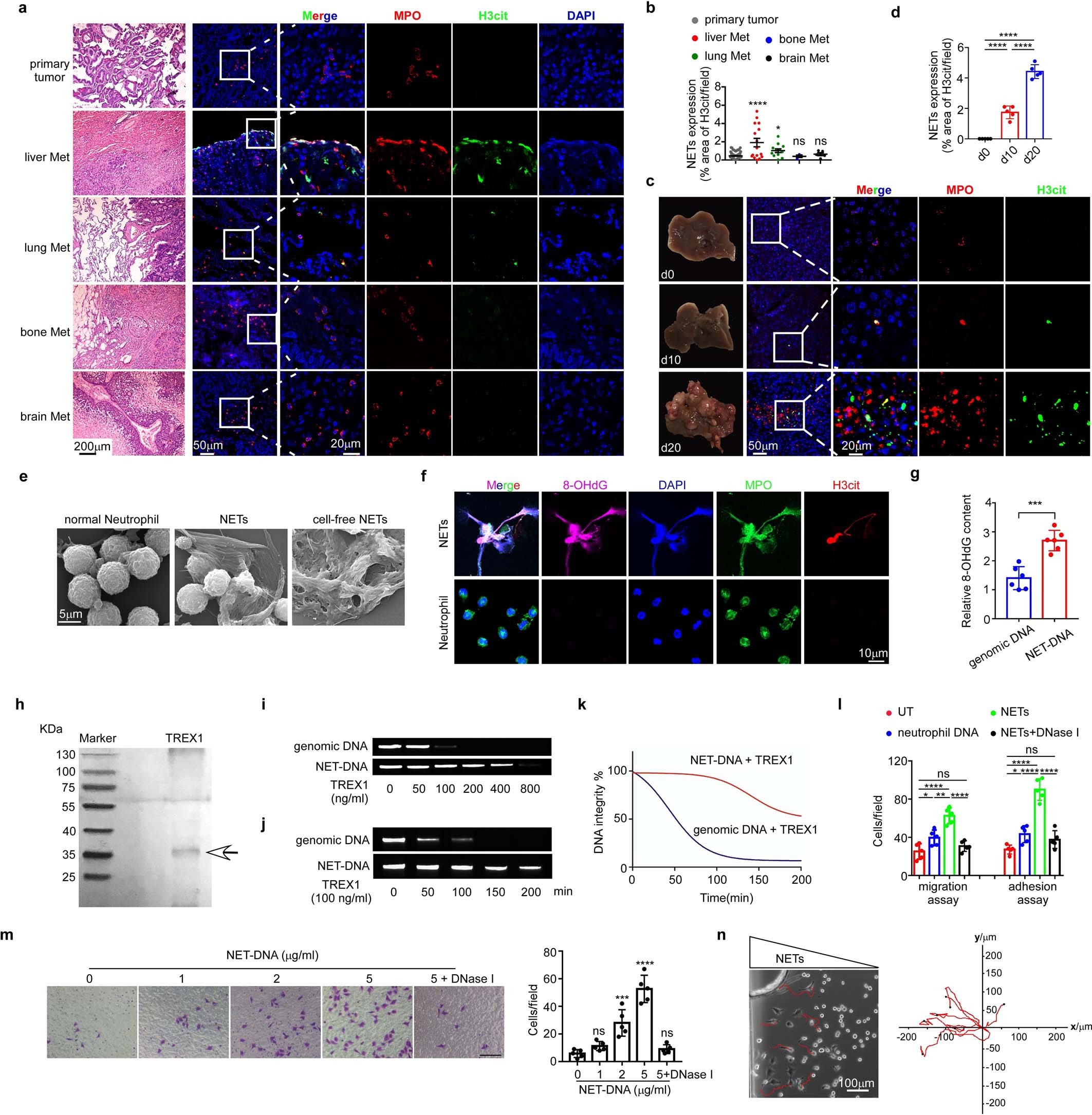 Extended Data Fig. 3: 8-OHdG-enriched NETs are predominantly detected in liver metastases of colon cancer.