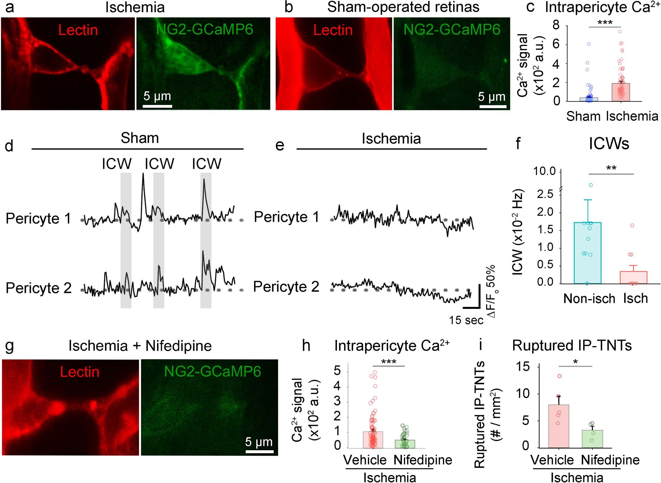 Extended Data Fig. 9: Ca2+ influx during ischaemia disrupts IP-TNT-mediated ICWs, and the Ca2+ blocker nifedipine protects IP-TNTs.