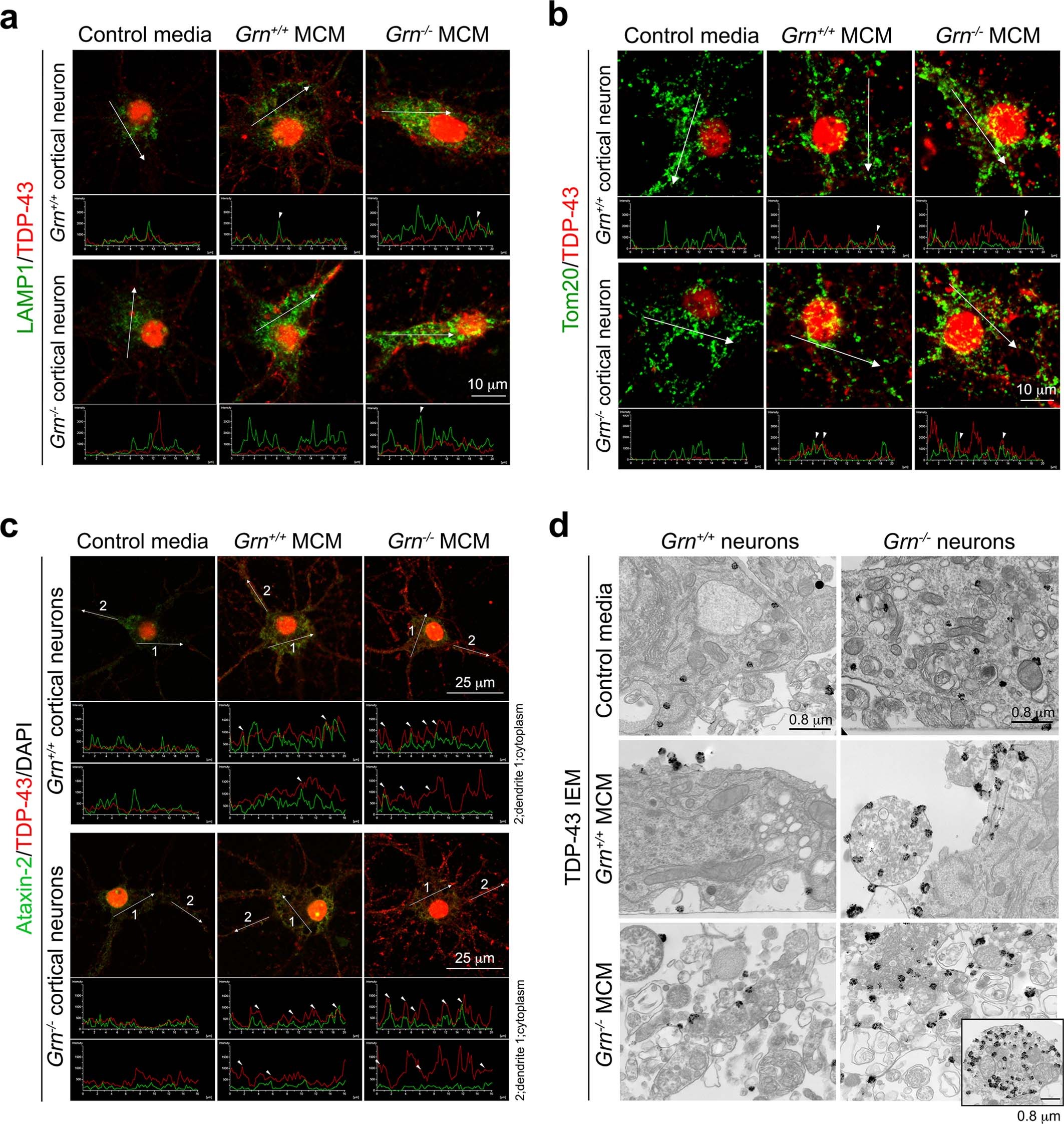Extended Data Fig. 8: Overlap between TDP-43 granules in Grn+/+ and Grn−/− neurons with lysosomal marker LAMP1, but not with the mitochondrial marker Tom20 and the stress granule marker ataxin-2.