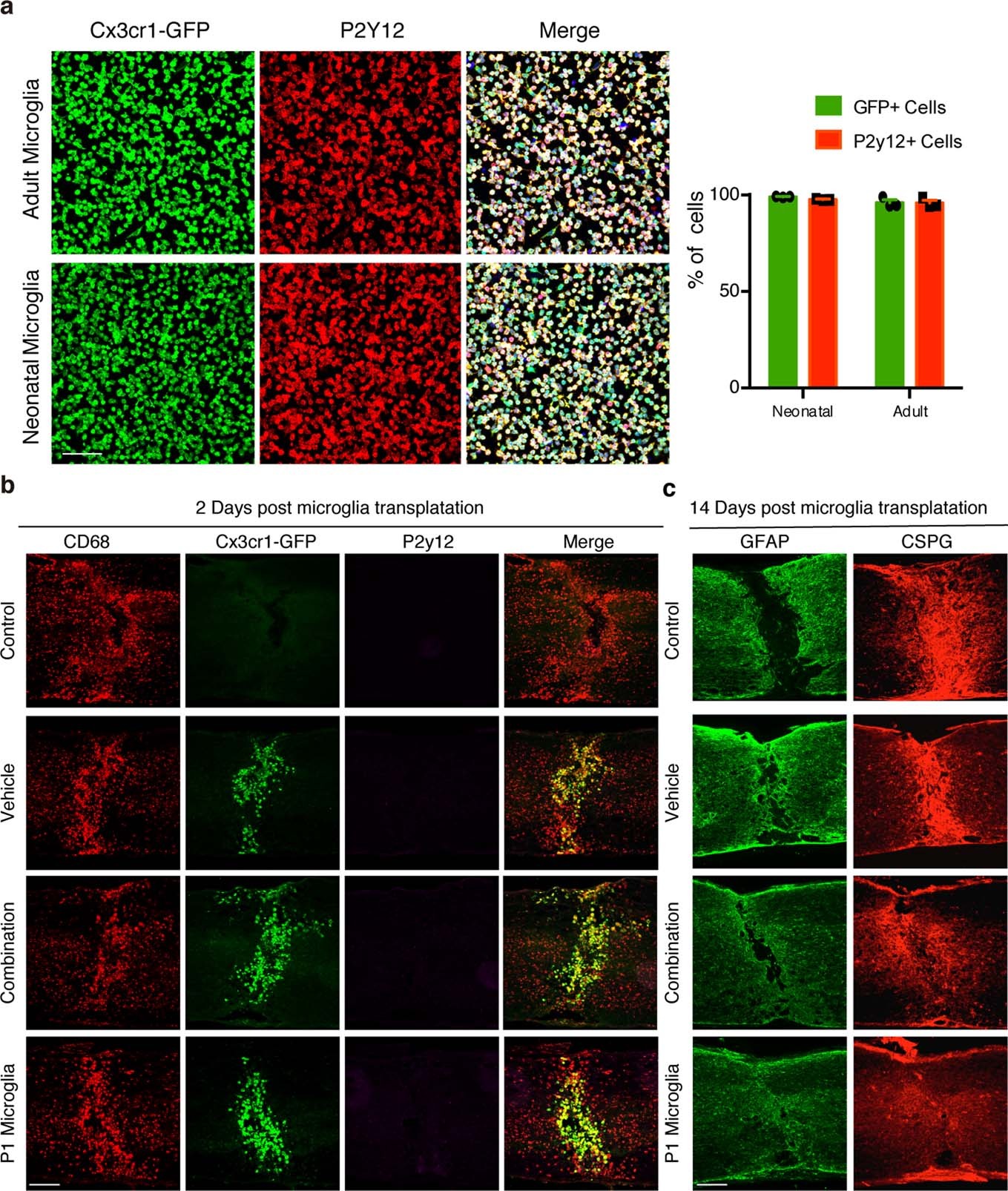 Extended Data Fig. 10: Microglia isolation and transplantation.
