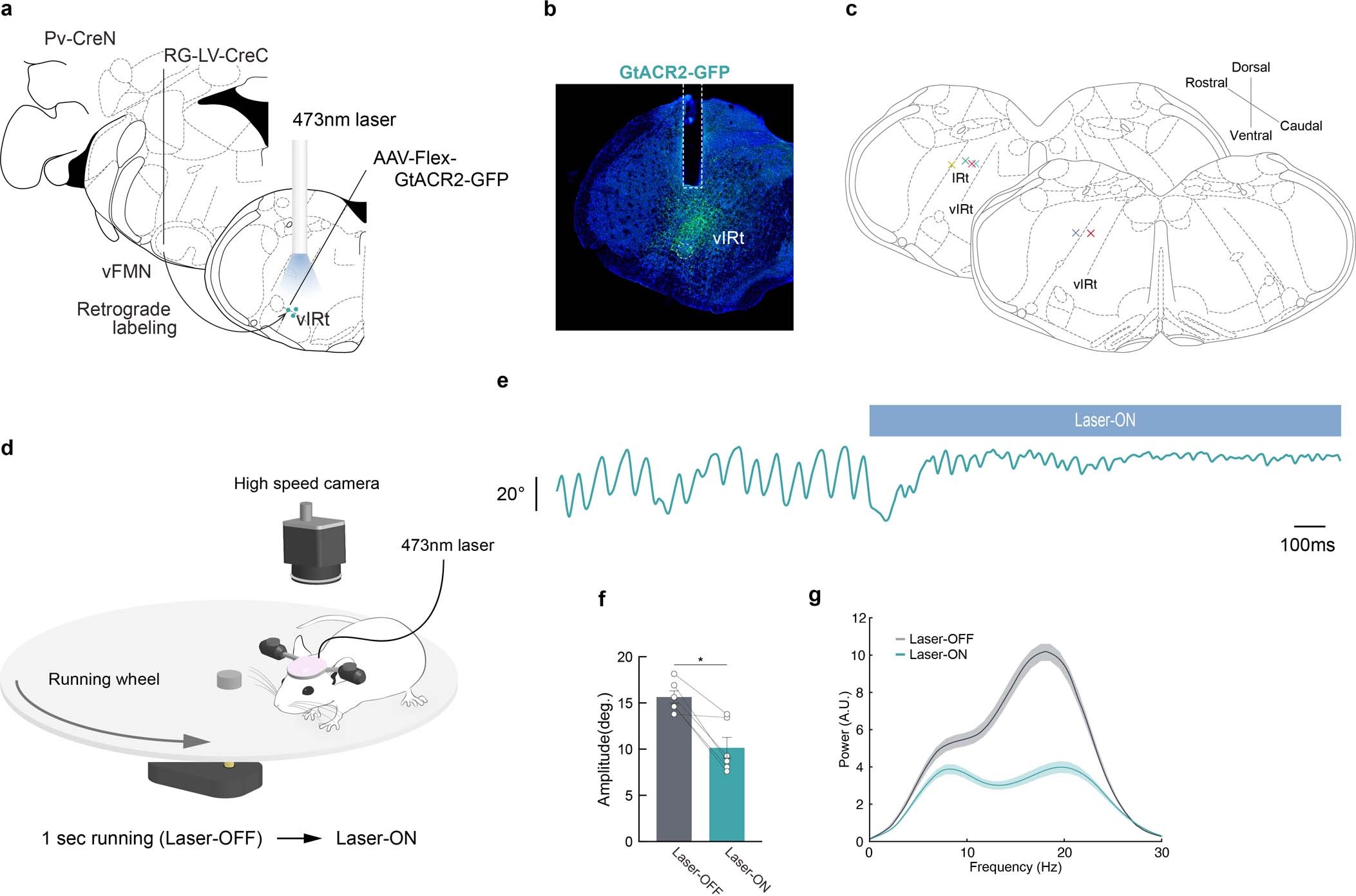 Extended Data Fig. 2: Optogenetic silencing of vIRtPV neurons also impaired whisking.