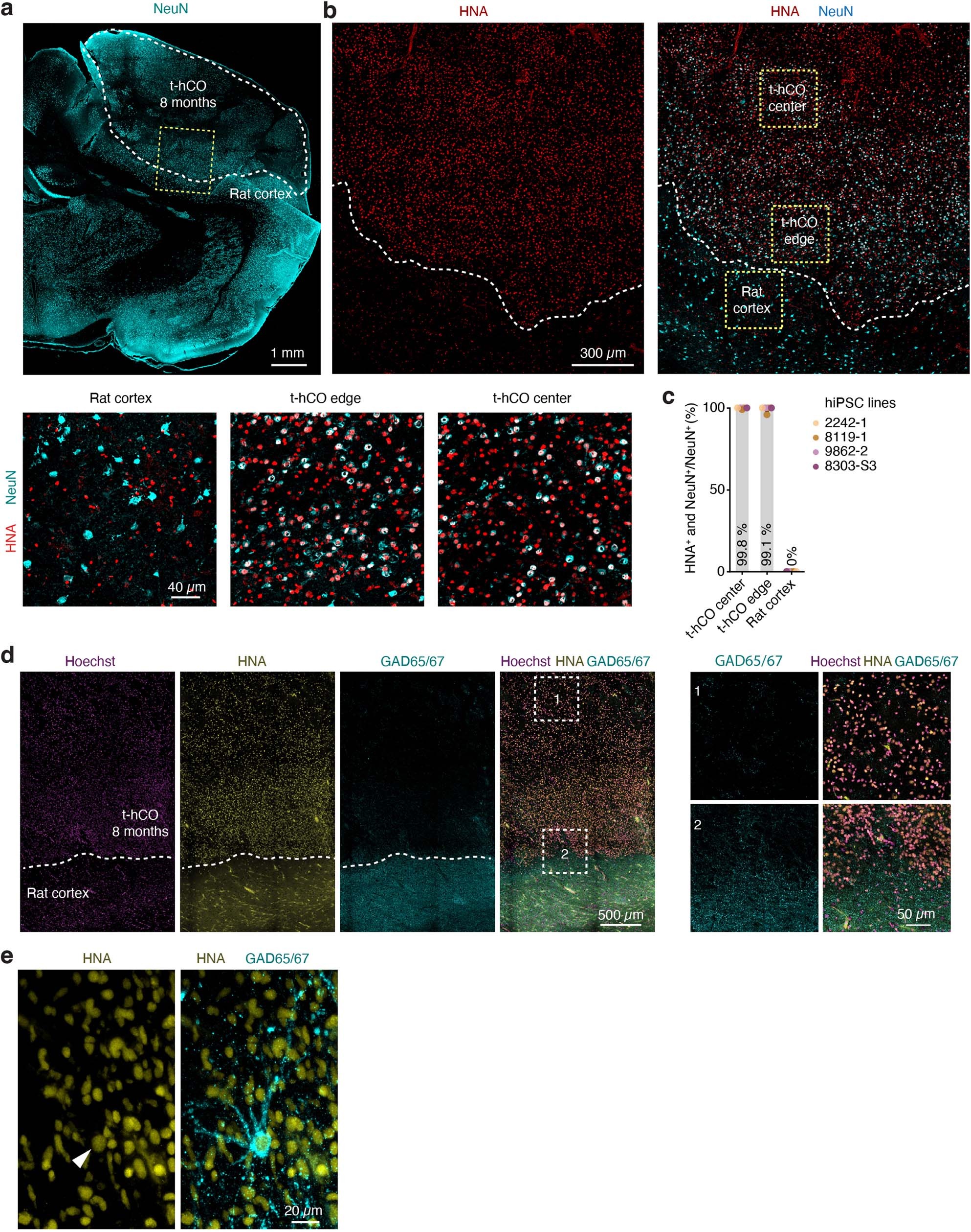 Extended Data Fig. 2: Immunohistochemical characterization of t-hCO.