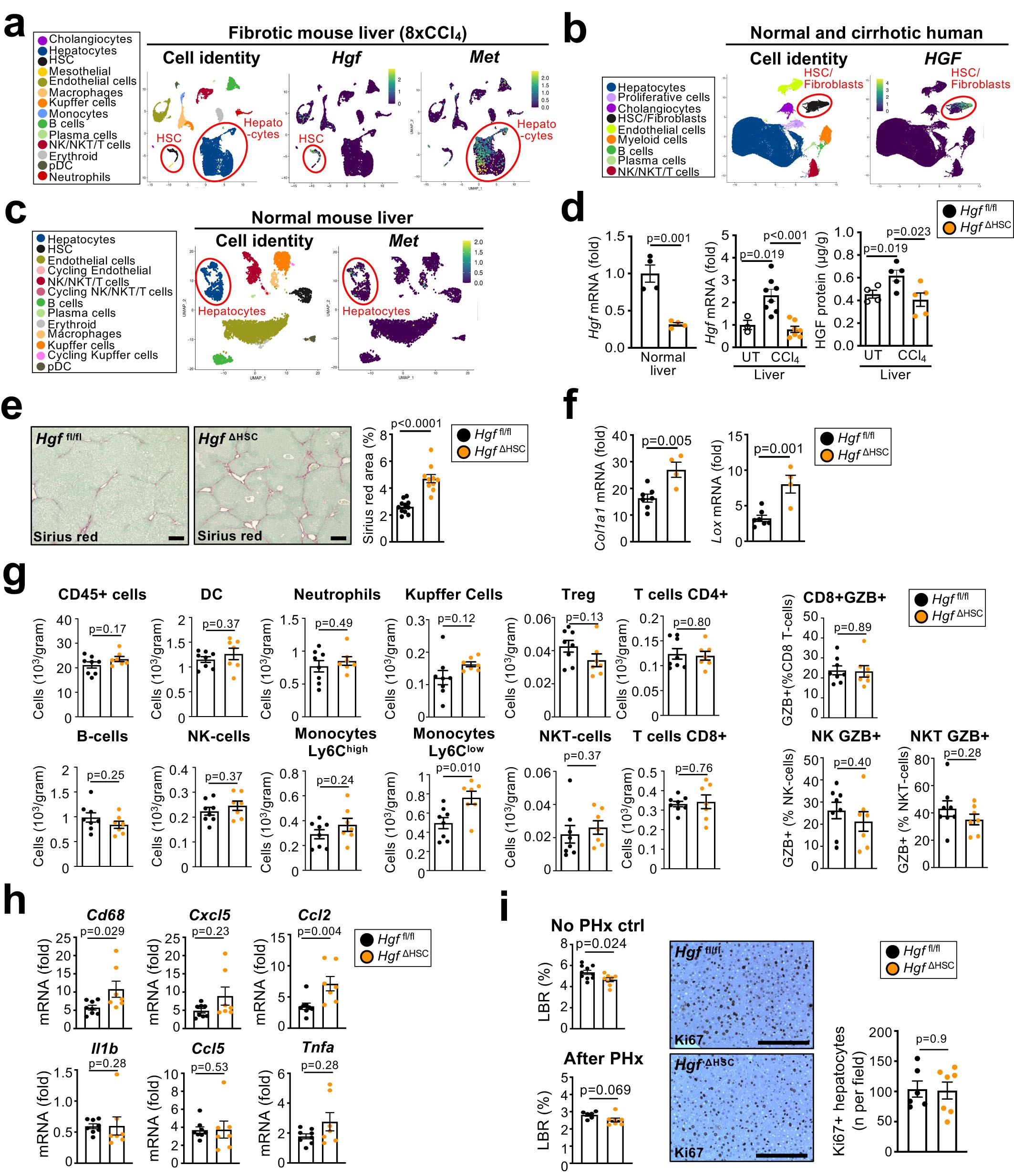 Extended Data Fig. 12: HGF deletion in HSC promotes fibrosis and inflammation in CCl4-induced liver injury.