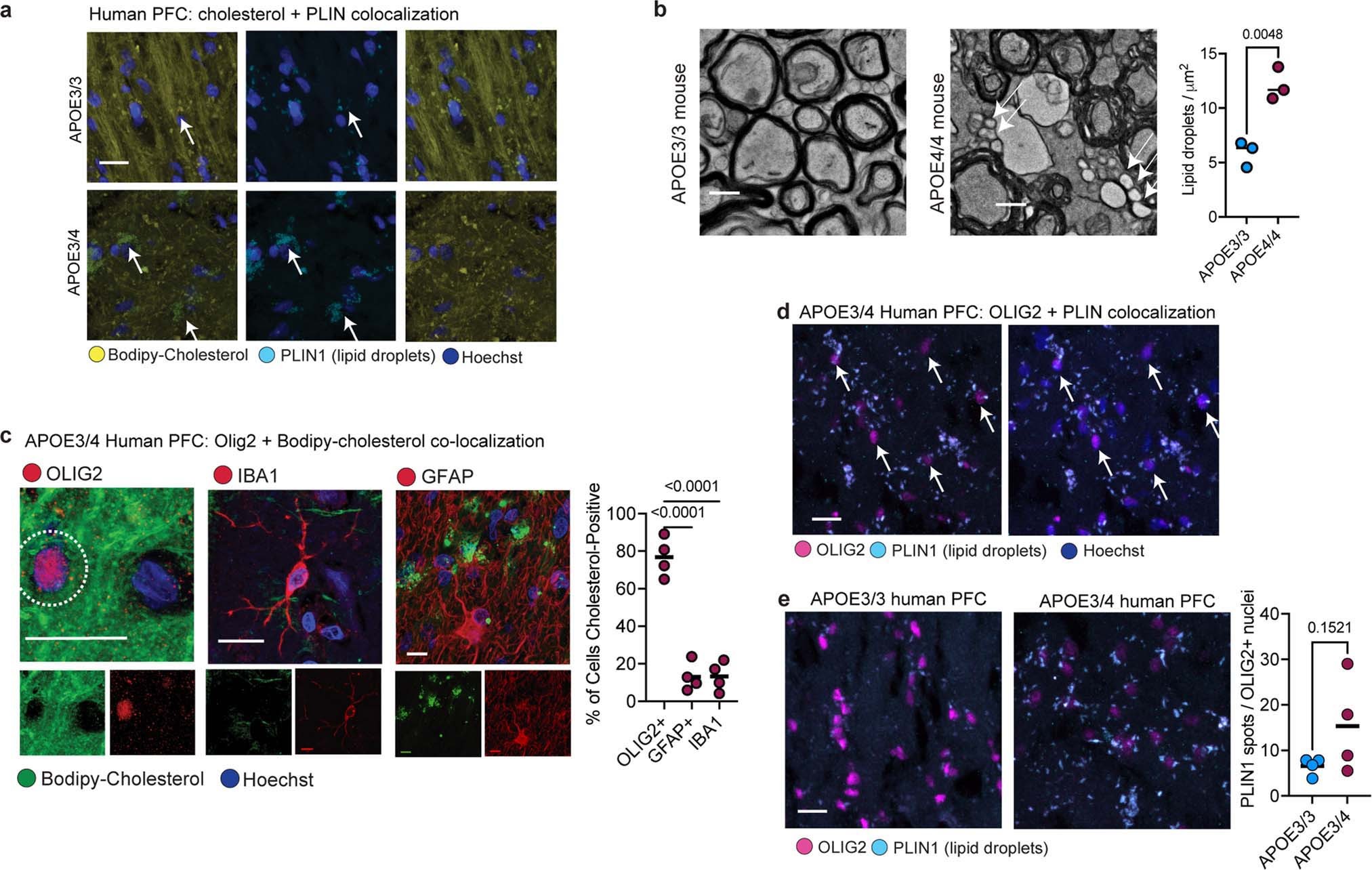 Extended Data Fig. 4: Lipid droplets in human and mouse brain.