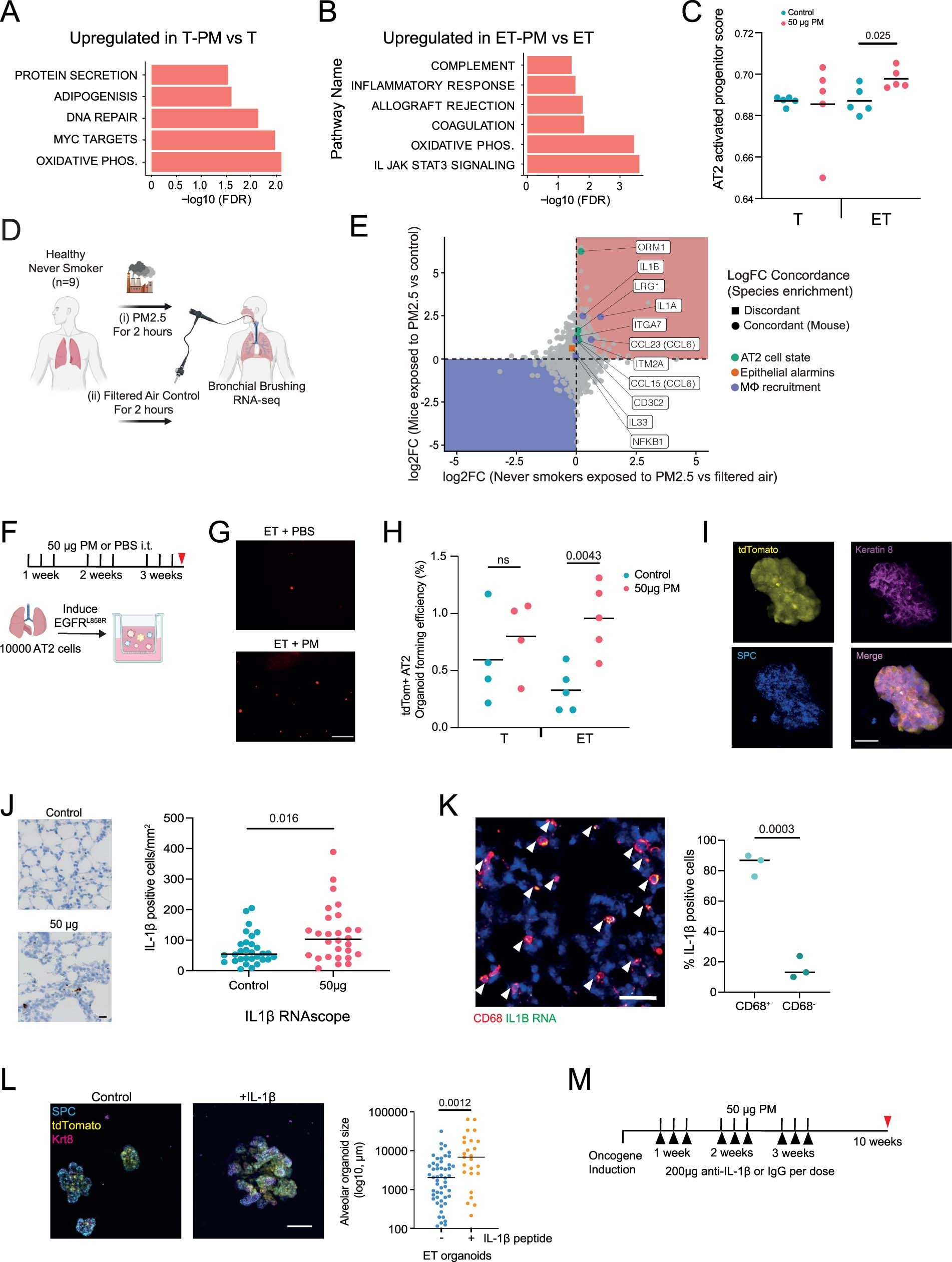 Extended Data Fig. 5: PM-mediated transcriptional changes, effects on AT2 cells and characterising IL-1β.