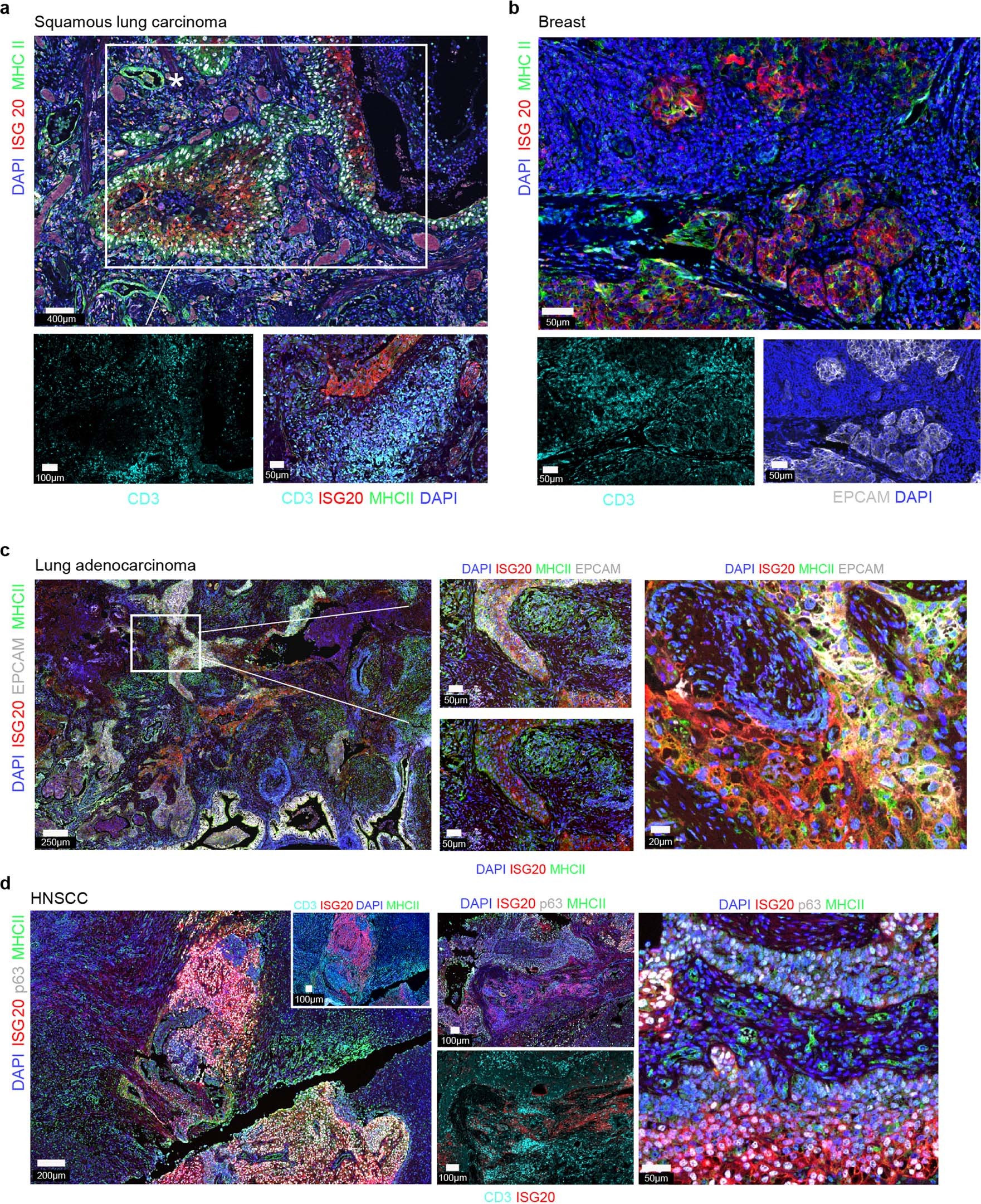 Extended Data Fig. 10: Coupling and decoupling of MHC-II and Interferon response.