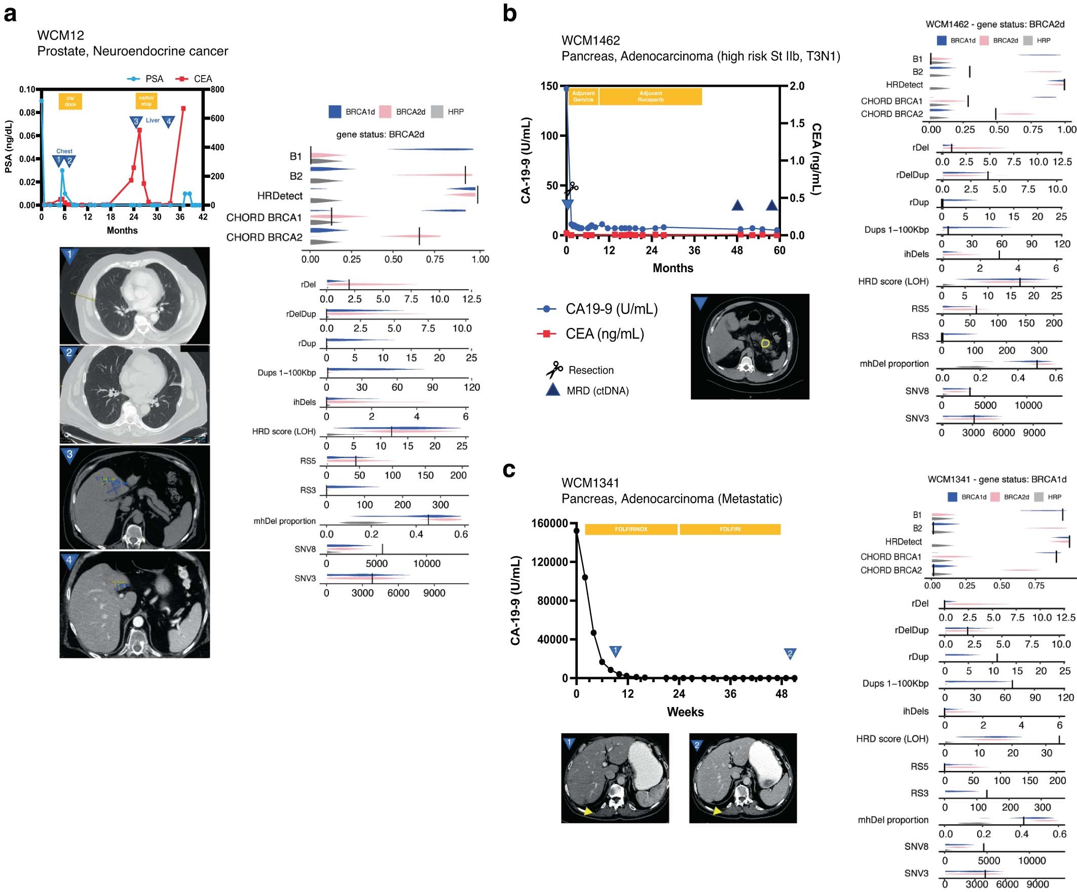 Extended Data Fig. 10: Clinical vignettes of patients with HRD tumours.