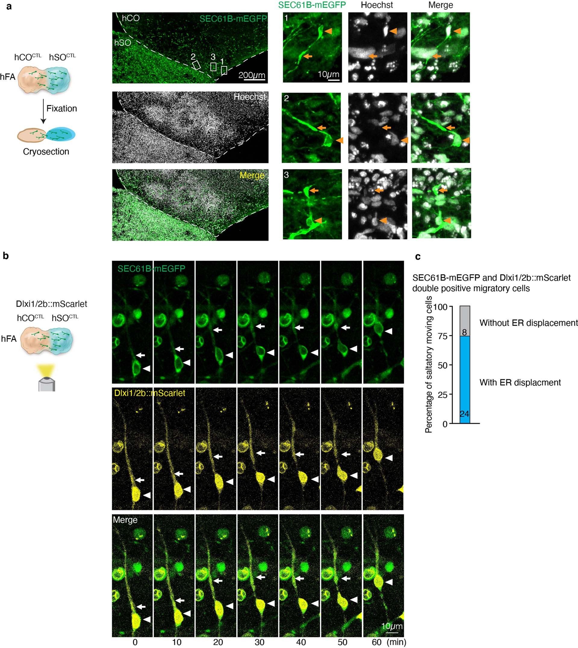 Extended Data Fig. 9: Migration-related ER displacement in fixed hFA and Dlxi1/2b::mScarlet+ cells.