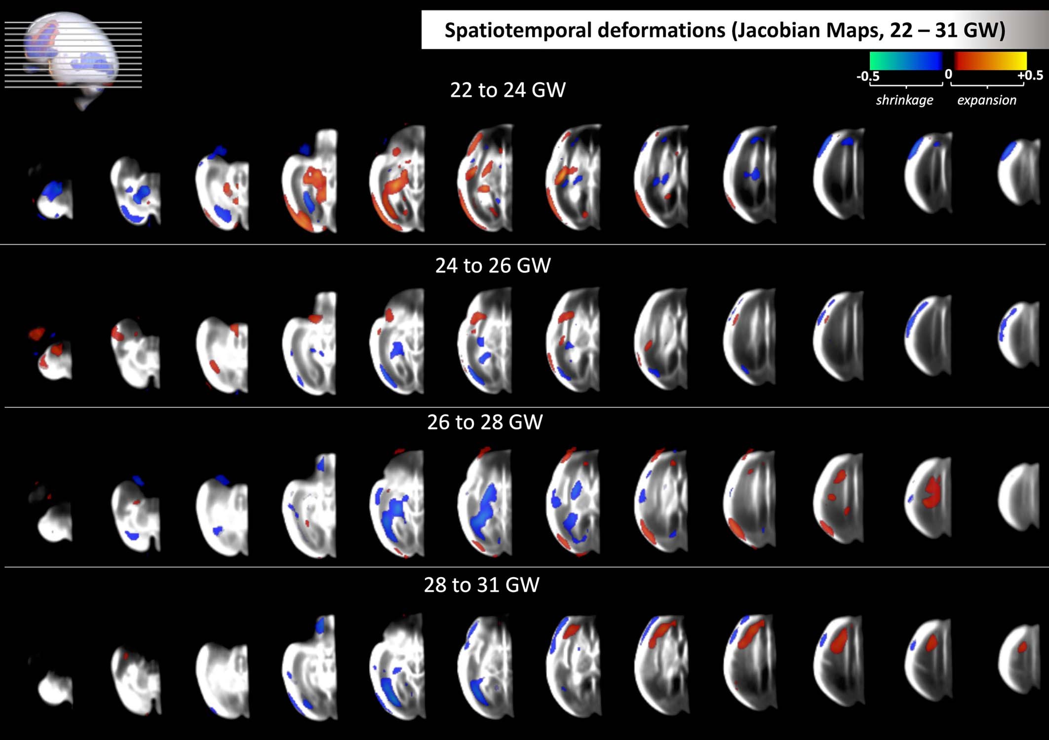 Extended Data Fig. 4: Spatial deformation maps from 22 to 31 weeks’ gestation.